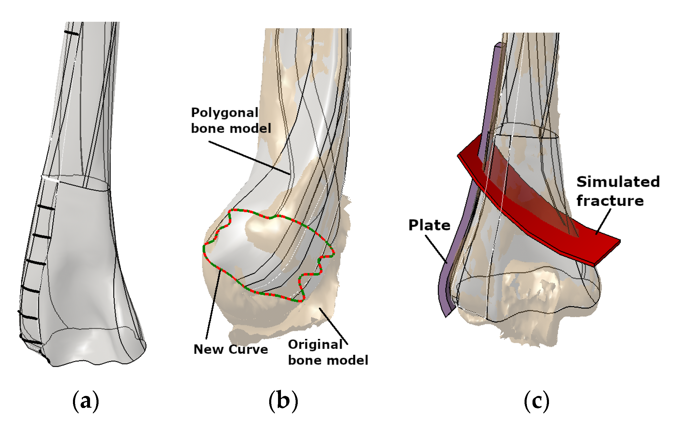 Humerus bone - Anatomy 3D model, Anatomy model of Humerus w…