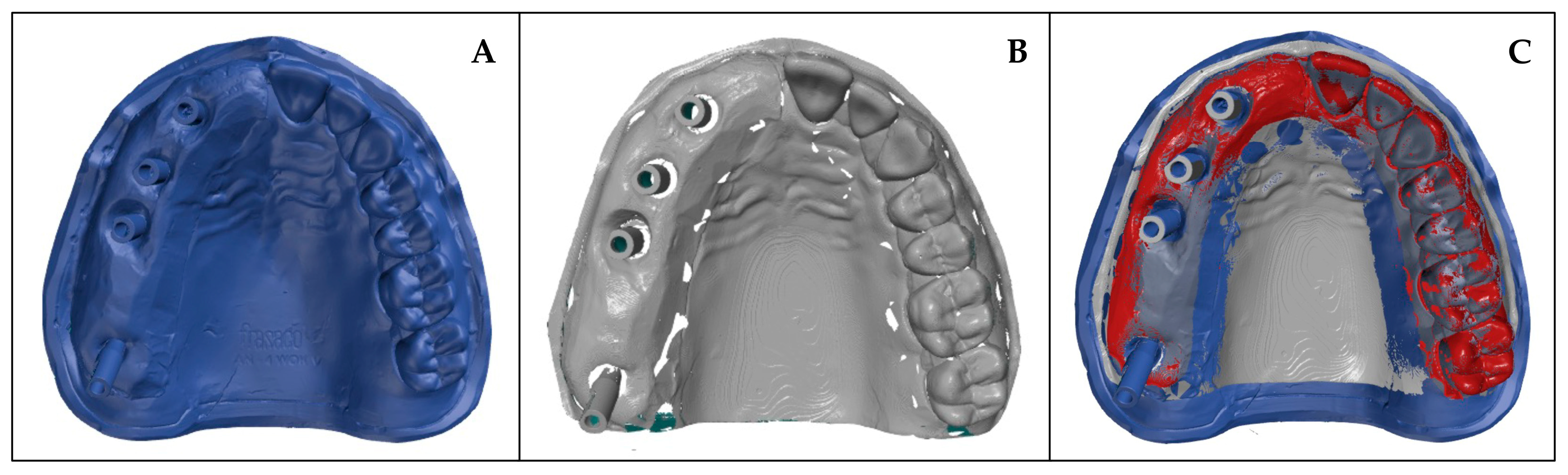 Influence of Model Design and Printing Orientation on the Dimensional ...