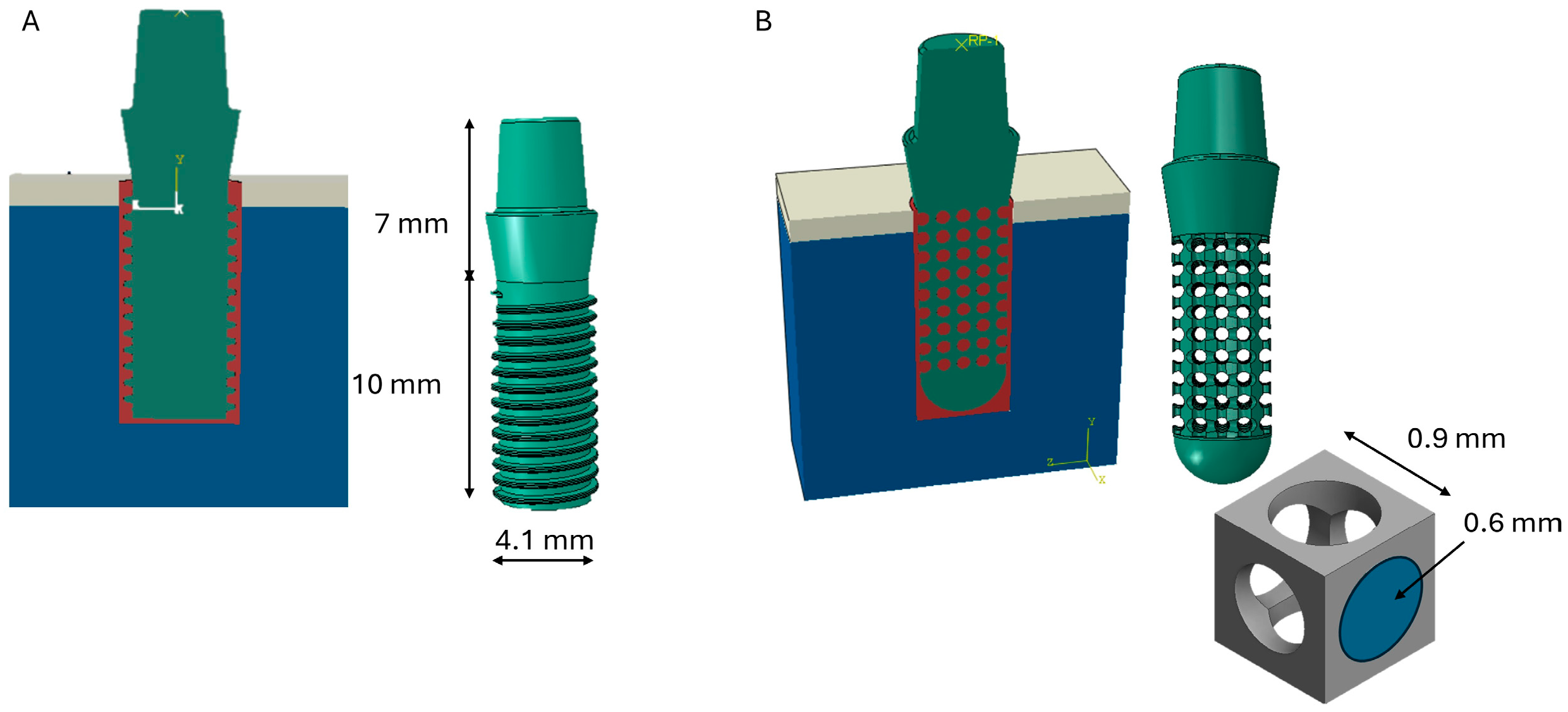 Influence of Immediate Versus Delayed Loading on Peri-Implant Bone ...