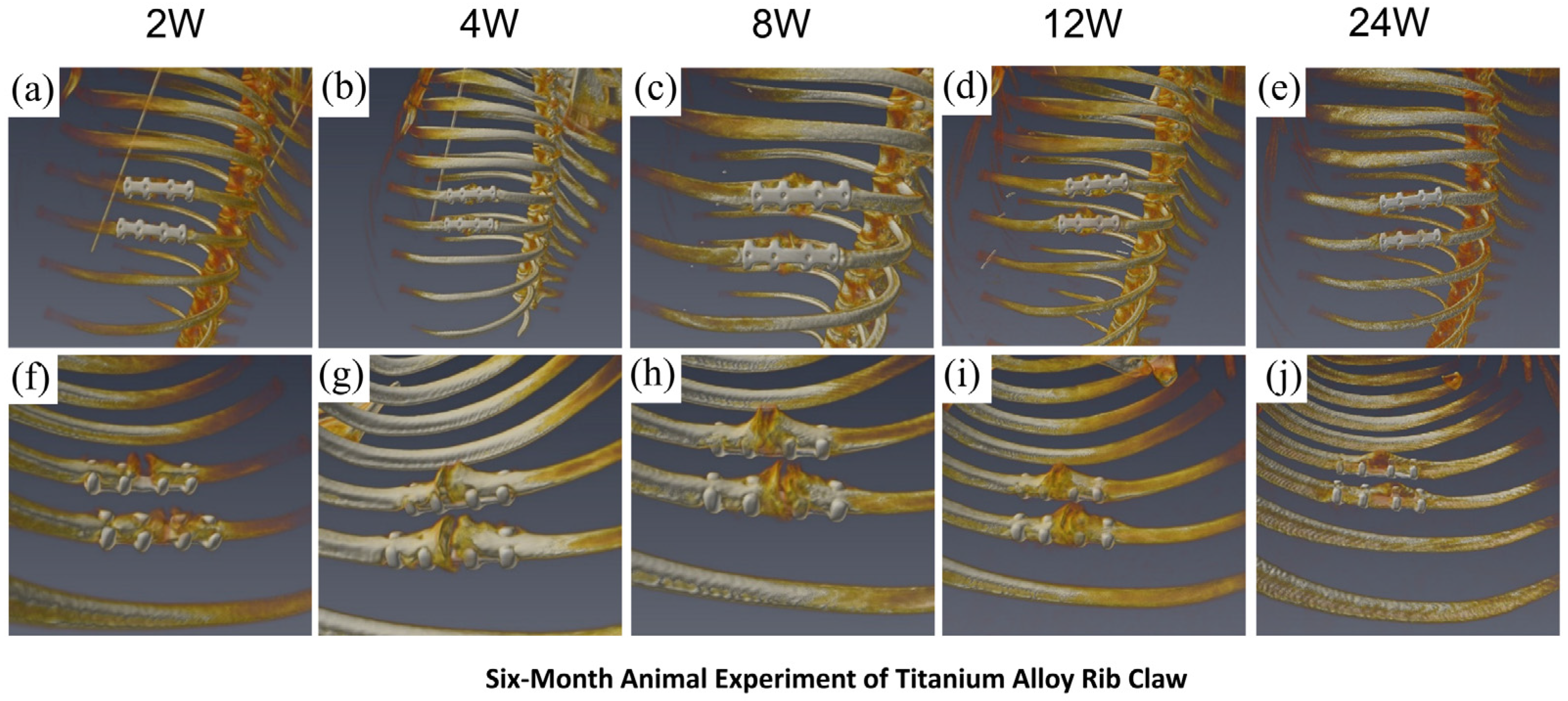 Macanical Ribs Structural Optimization of Magnesium Alloy Rib Claw and Evaluation of ...