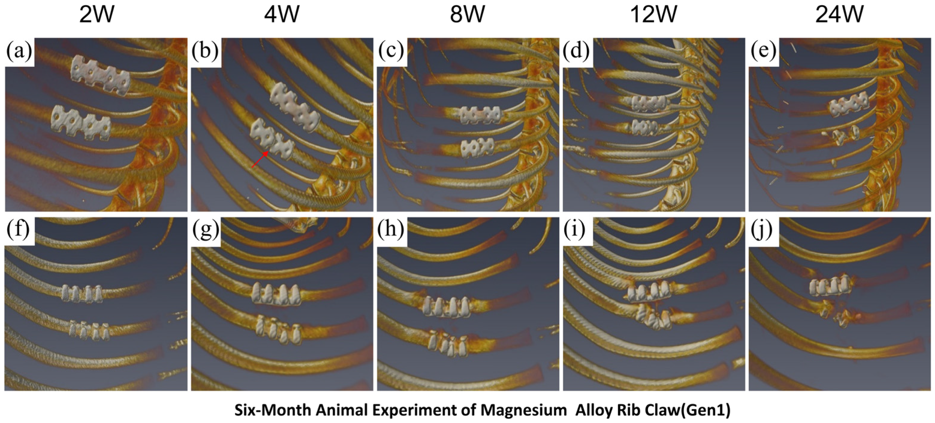 Macanical Ribs Structural Optimization of Magnesium Alloy Rib Claw and Evaluation of ...