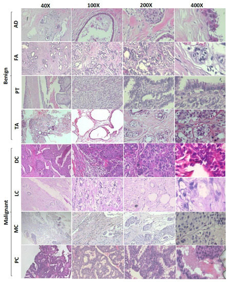 BreaST-Net: Multi-Class Classification of Breast Cancer from ...