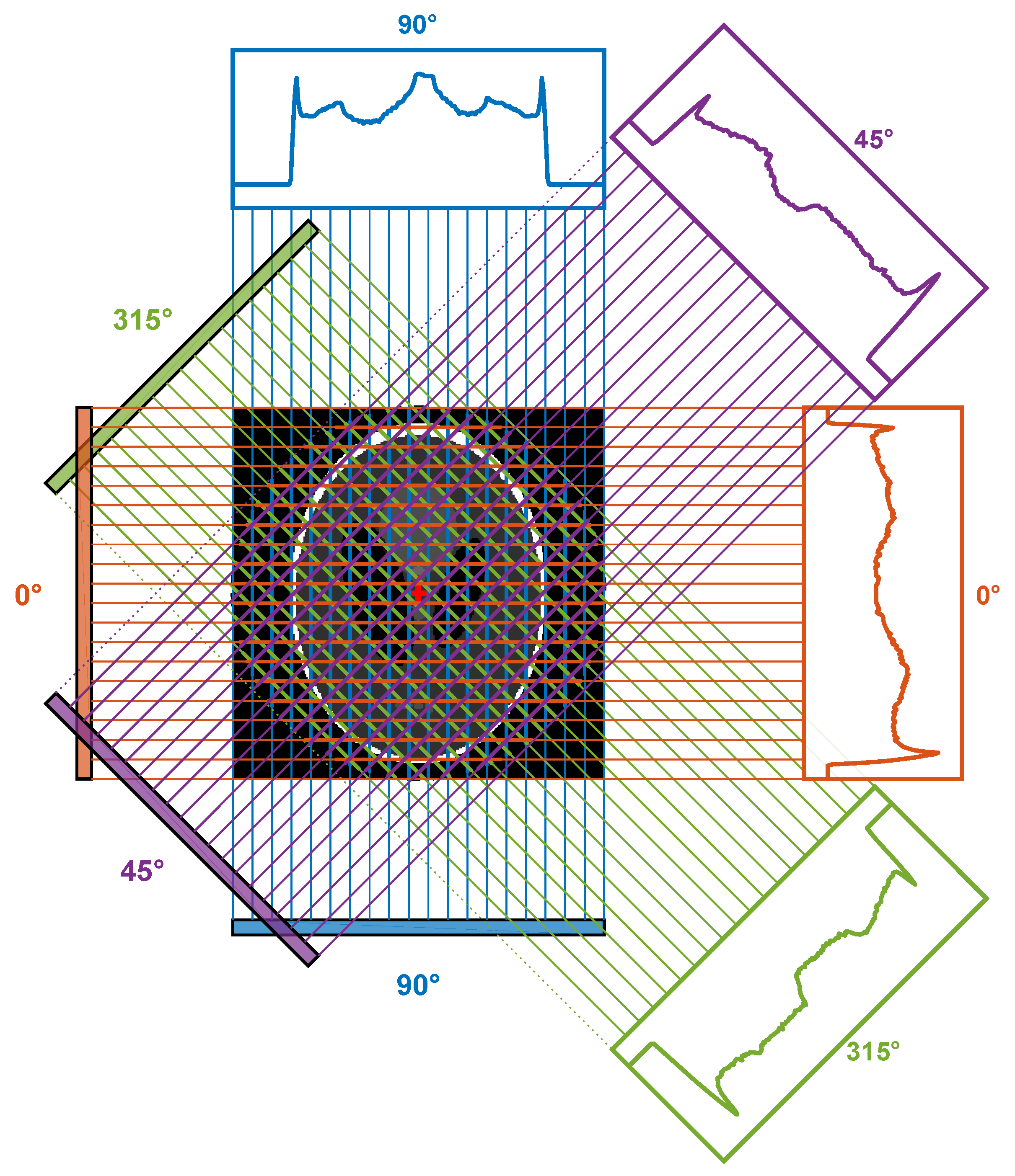 Metal Artifact Reduction in CT Based on a Nonlinear Weighted ...
