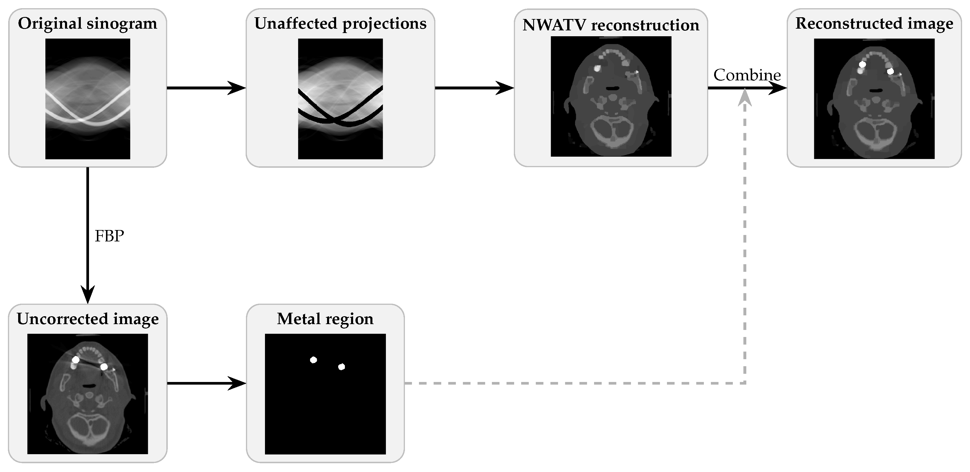 Metal Artifact Reduction in CT Based on a Nonlinear Weighted ...