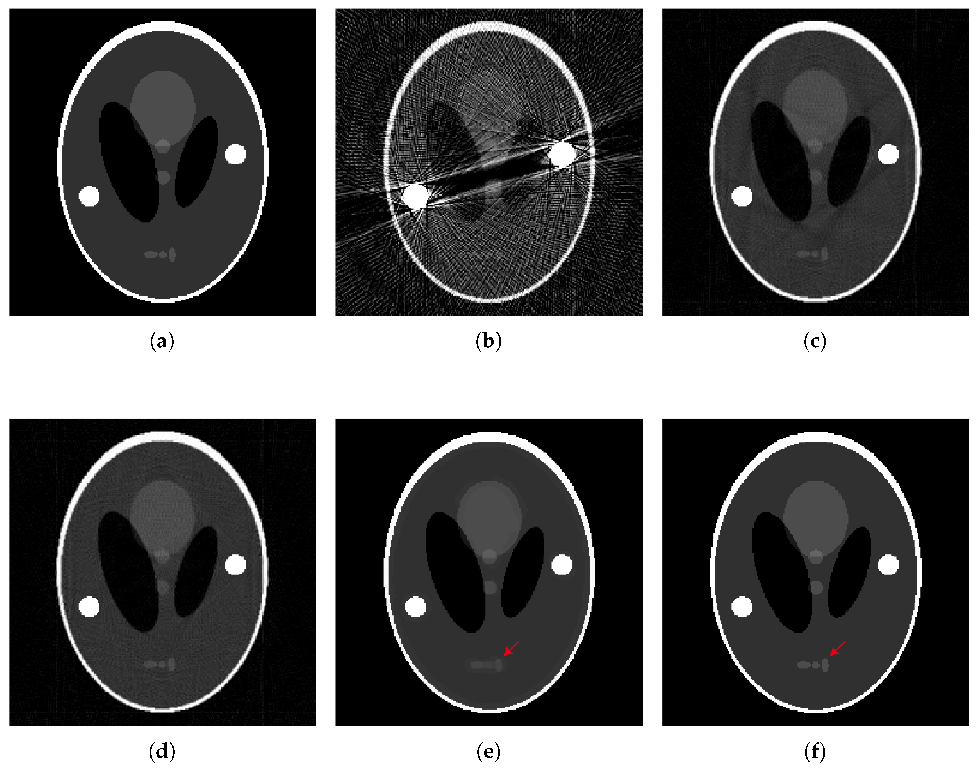 Metal Artifact Reduction in CT Based on a Nonlinear Weighted ...