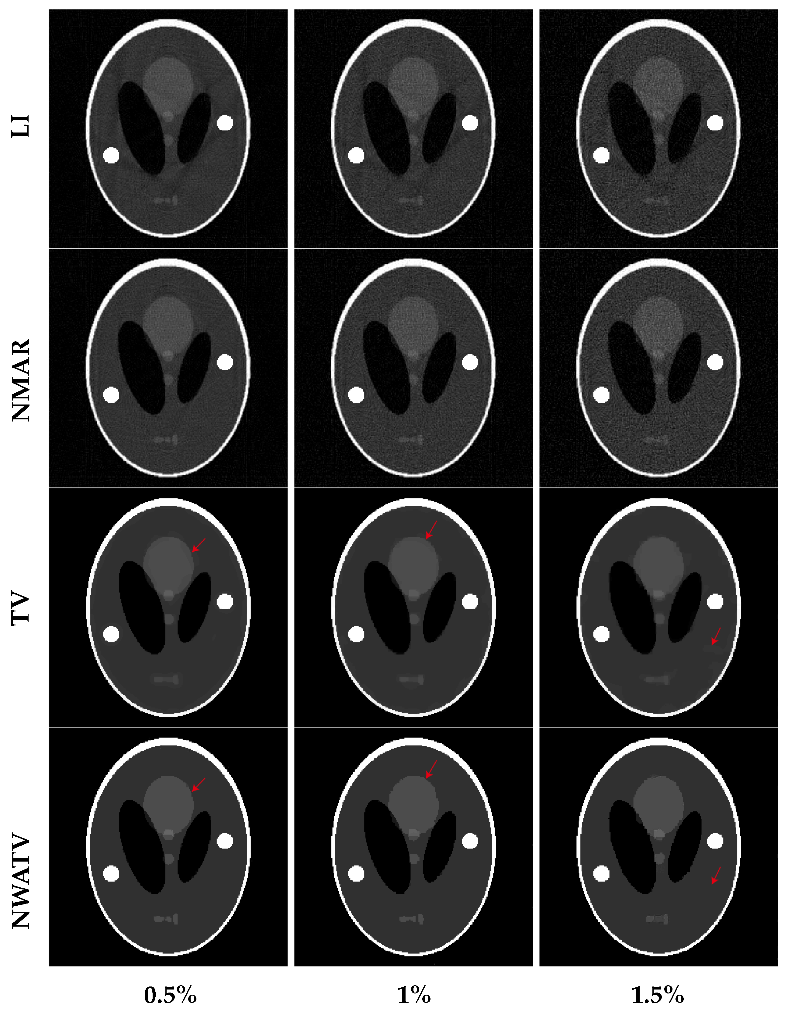 Metal Artifact Reduction in CT Based on a Nonlinear Weighted ...