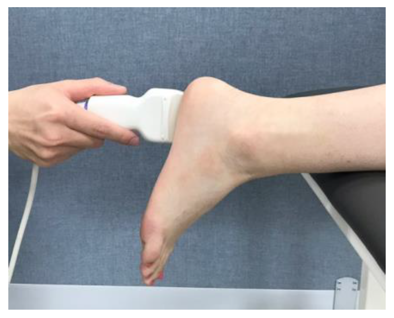Foot Sprain (Metatarsophalangeal Joint): Exercises