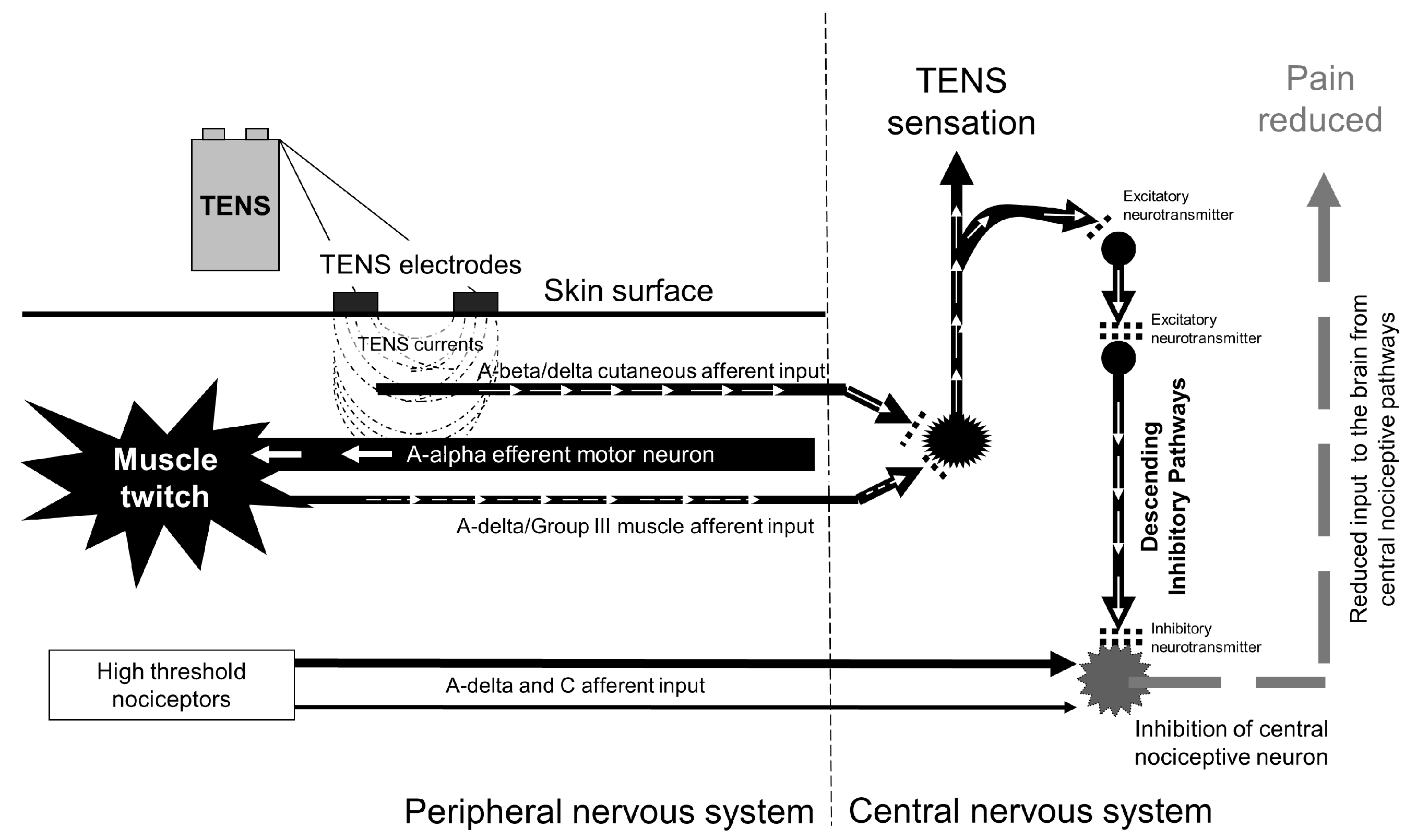 TENS (transcutaneous electrical nerve stimulation) - NHS