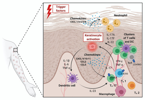 Medicina | Free Full-Text | The Role of Chemokines in Psoriasis—An Overview