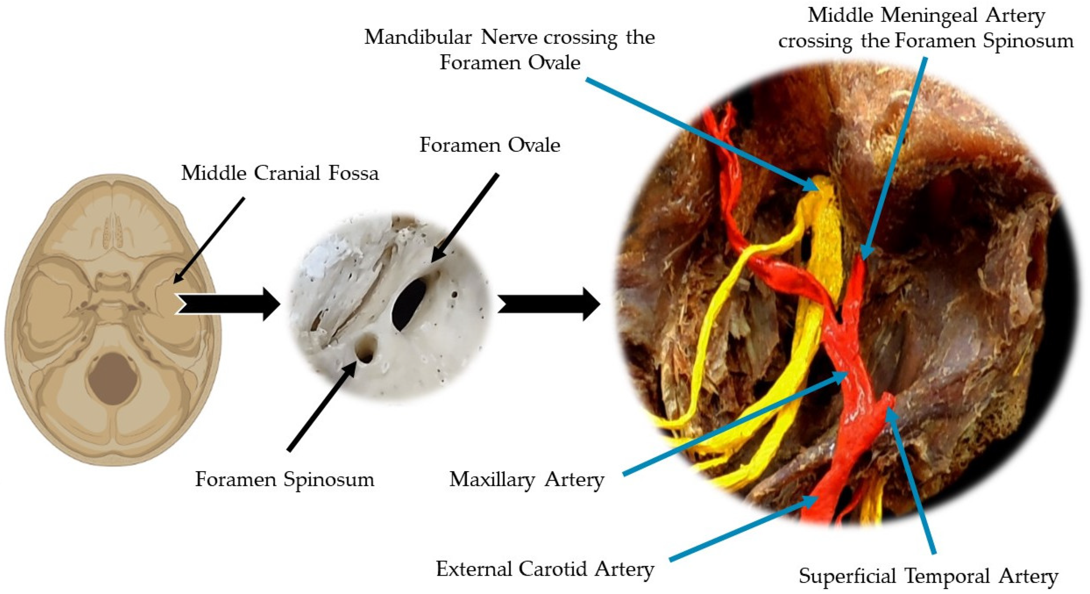 PDF] A review of the mandibular and maxillary nerve supplies and their  clinical relevance.