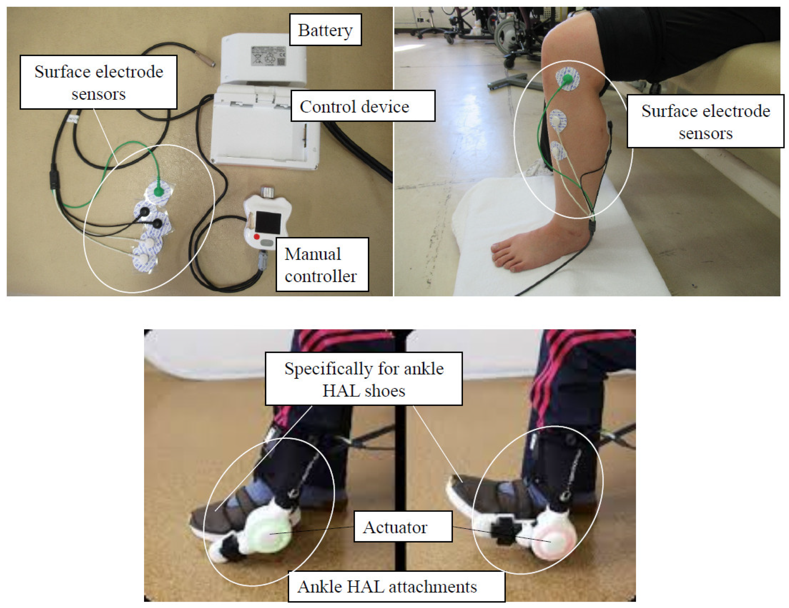 Functional electrical stimulation (FES) in orthopaedics