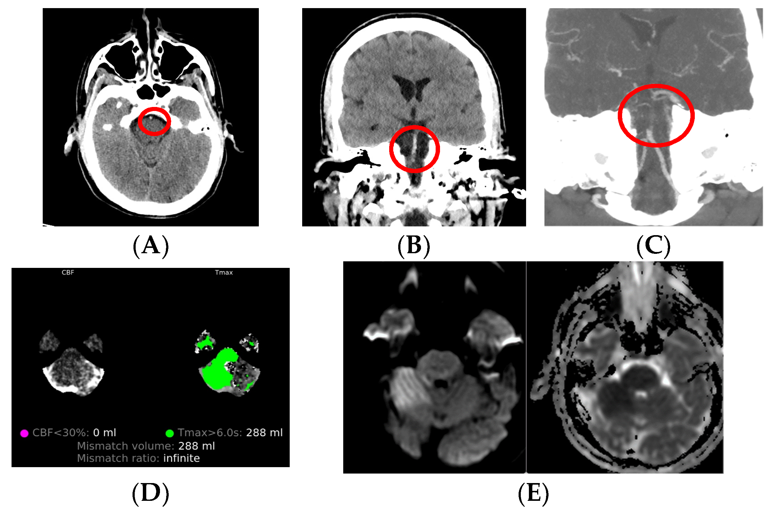 Medicina | Free Full-Text | Neuroimaging Modalities Used for 