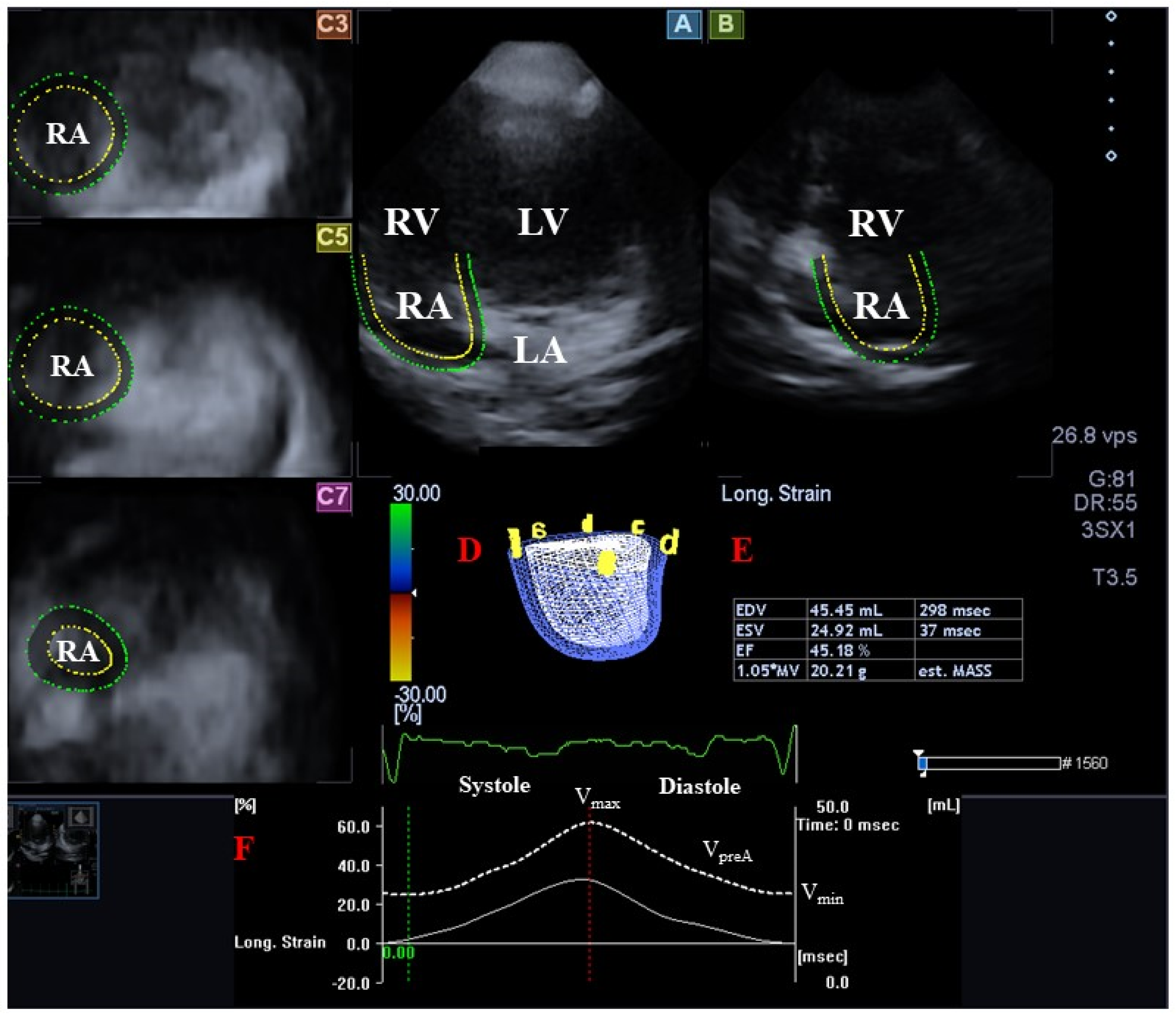 Time-course changes in echo-derived parameters: (a) LV mass (echo
