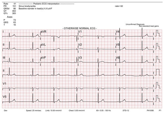 Medicina | Free Full-Text | Smooth Emergence from General Anesthesia ...