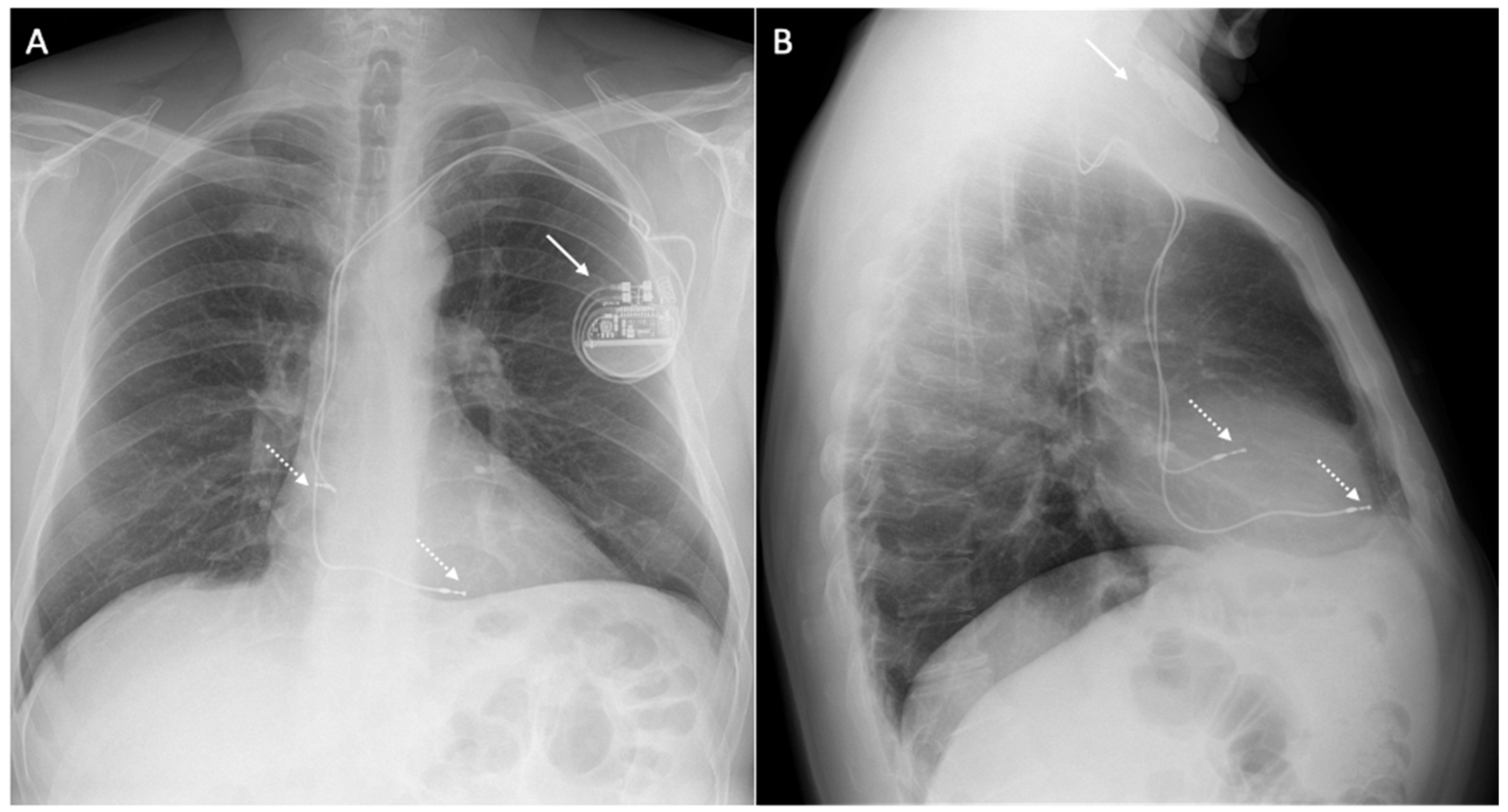 Medicina | Free Full-Text | Cardiac Magnetic Resonance and Cardiac ...