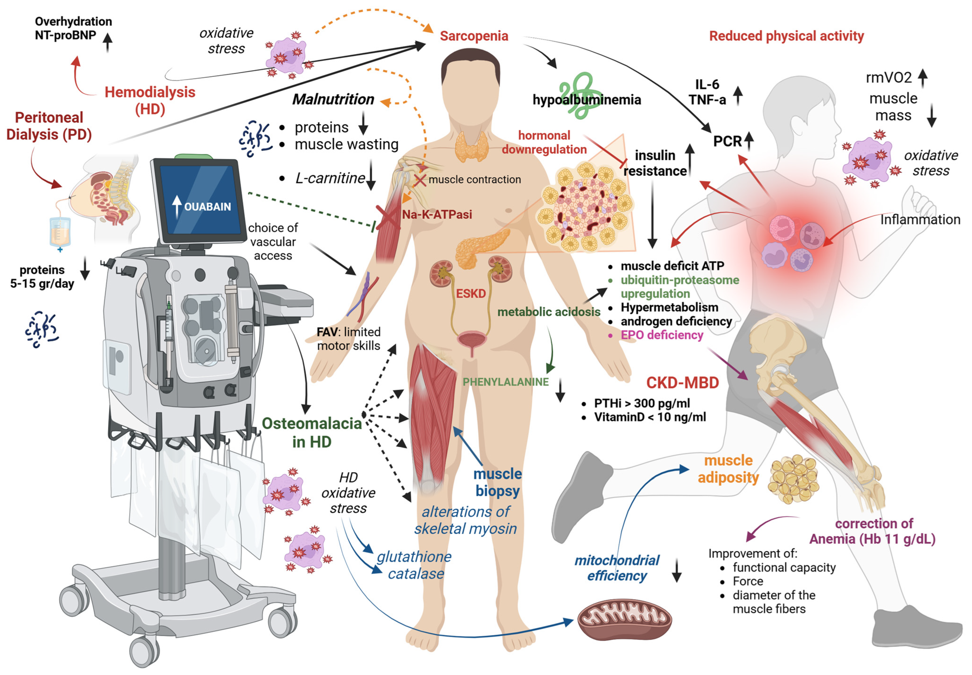 Comprehensive Insights into Sarcopenia in Dialysis Patients: Mechanisms ...