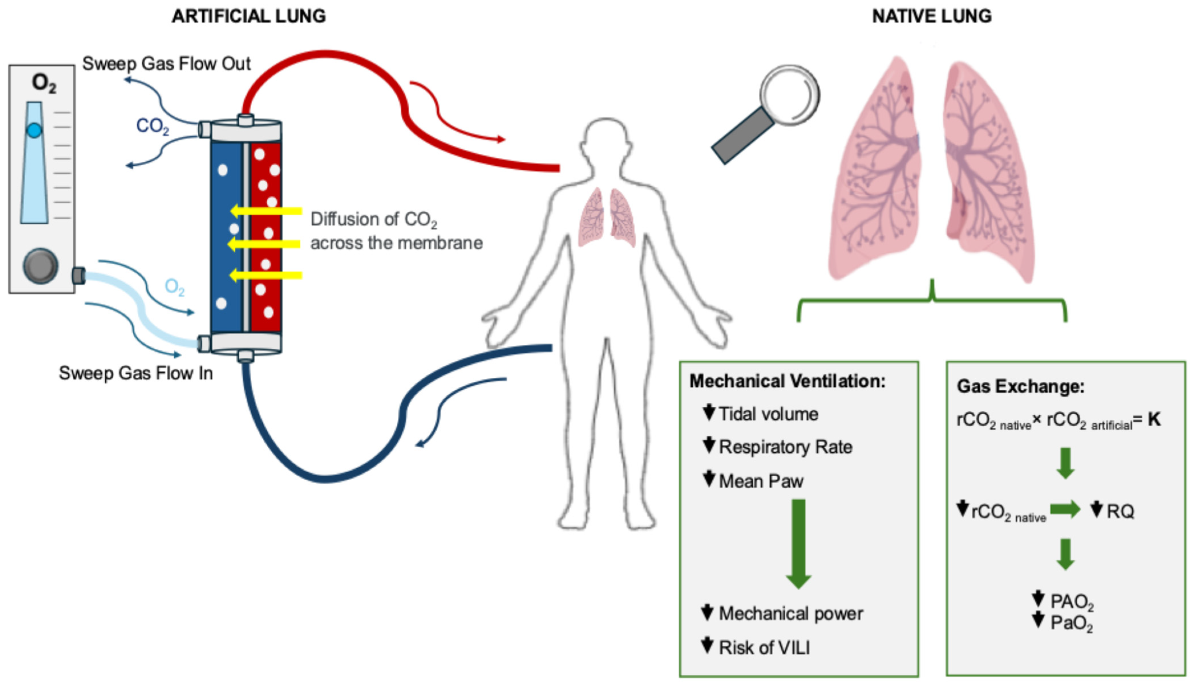 Extracorporeal Carbon Dioxide Removal in Acute Respiratory Distress ...