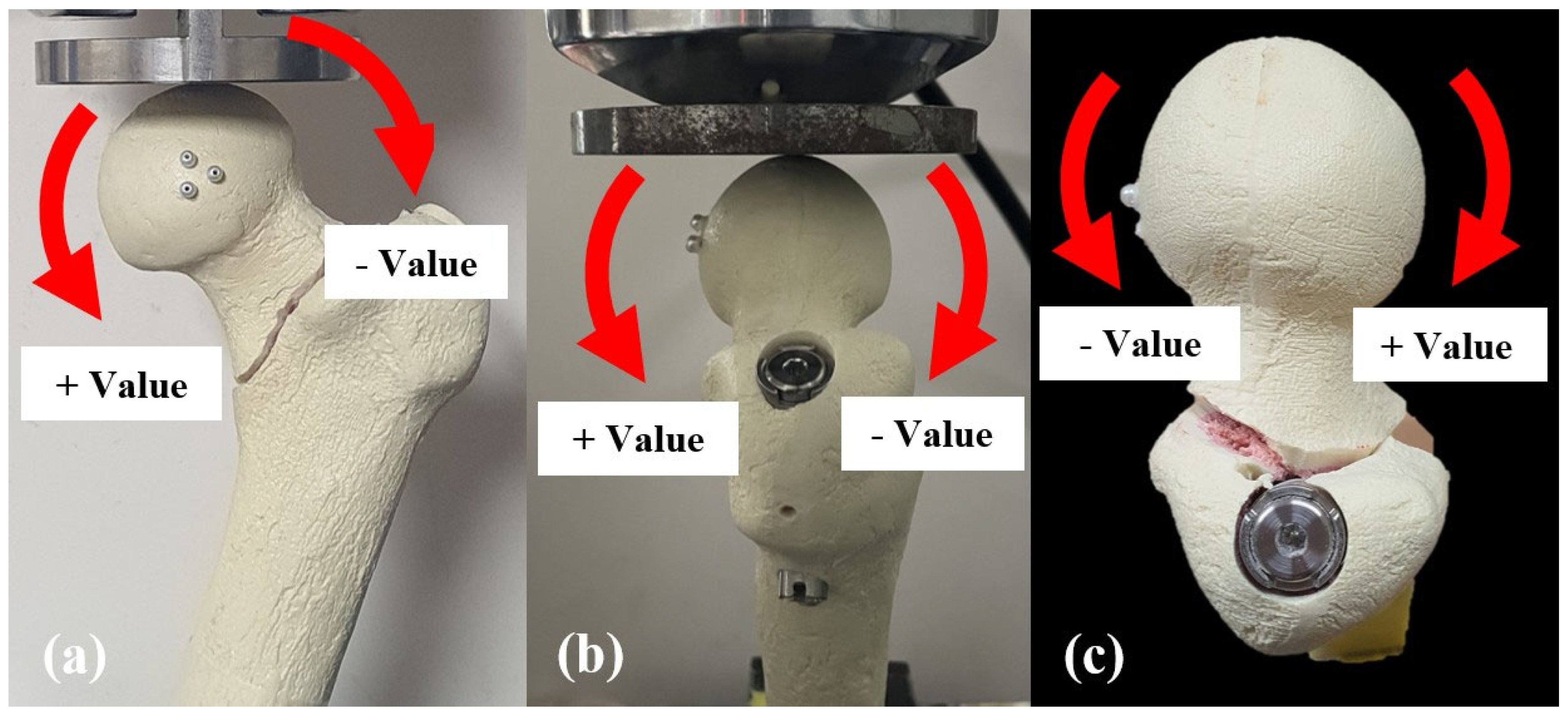Biomechanical Comparison of Three Different Fixation Methods for ...