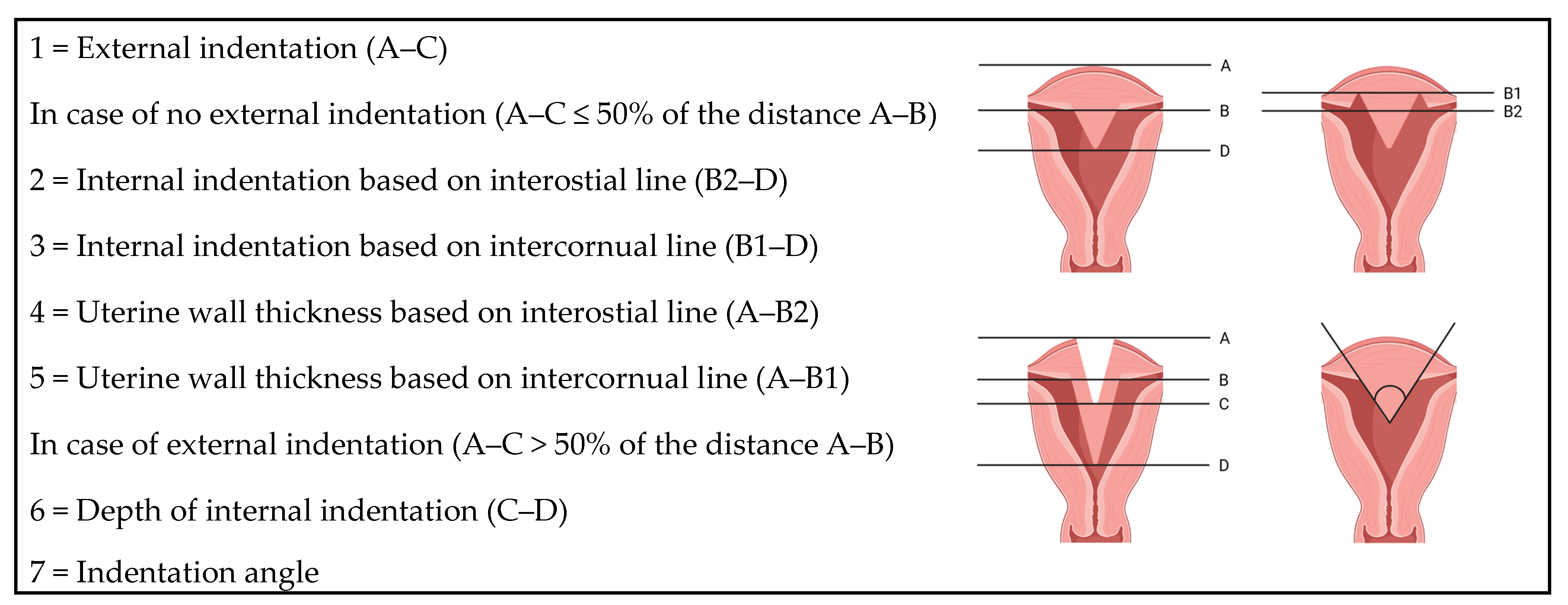 Comparison of Different Classification Systems for Müllerian Duct ...
