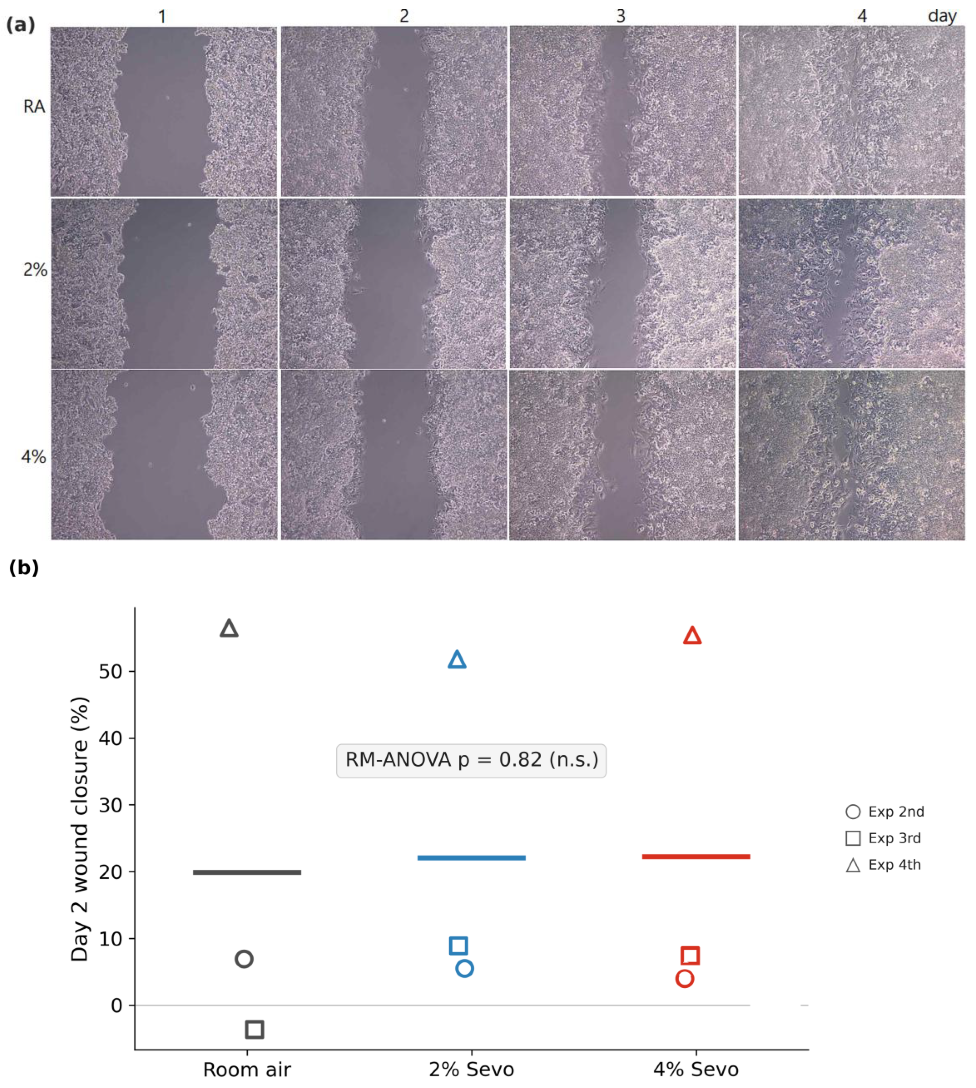 Effects of Sevoflurane on the Proliferation, Migration, and Xenograft ...