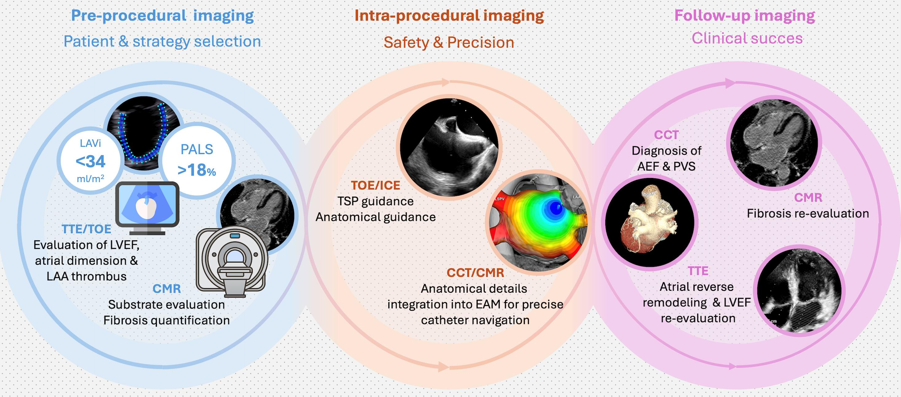 The Role of Multimodality Imaging in Atrial Fibrillation and Heart ...