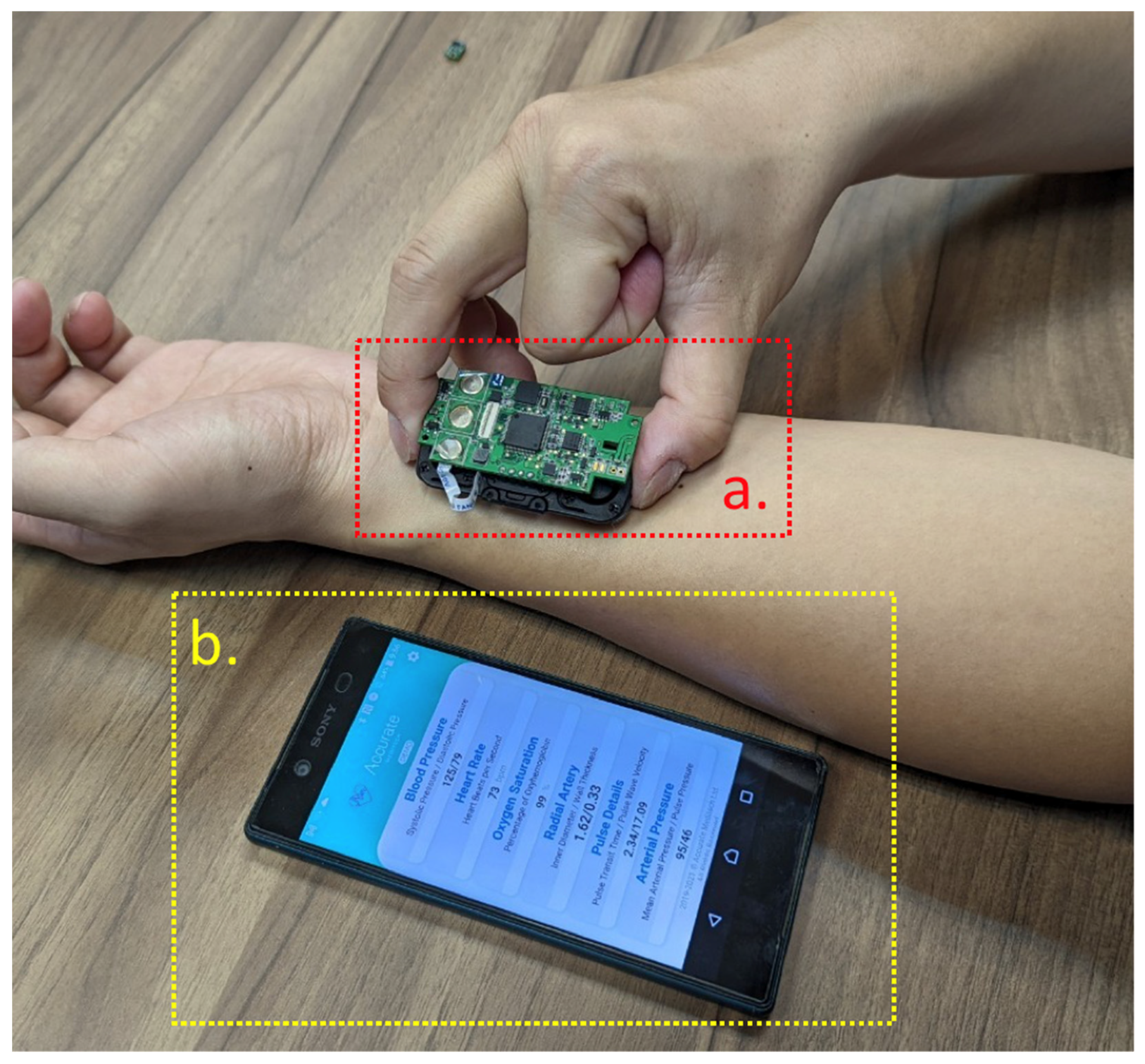 Emerging sensing and modeling technologies for wearable and cuffless blood  pressure monitoring