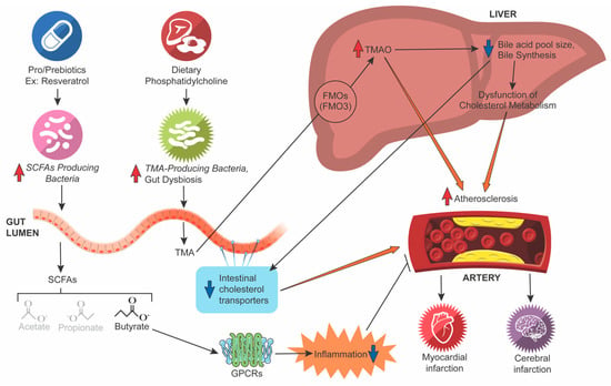 Microorganisms | Free Full-Text | Gut Dysbiosis and Immune System in ...