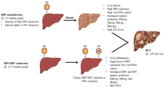 Microorganisms | Free Full-Text | Viral Diagnosis of Hepatitis B and ...