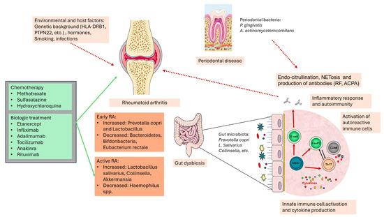 The Role Of Microbiome In Rheumatoid Arthritis Treatment – BYAMJ