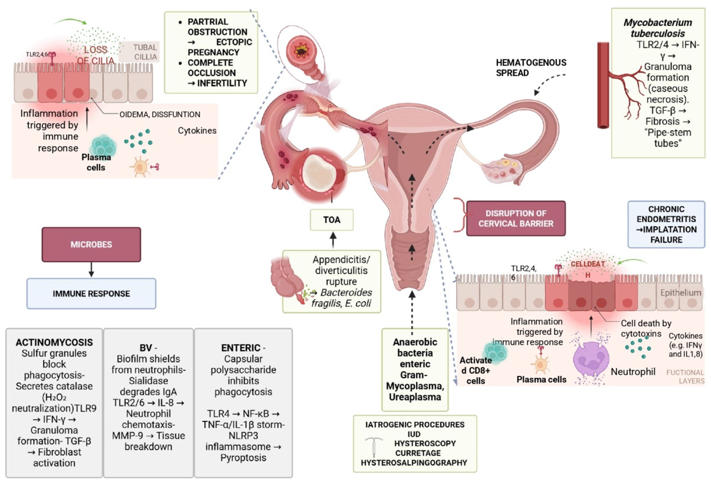 Non Sexually Transmitted Infection STI Related Pelvic Inflammatory Non Sexually Transmitted Infection STI Related Pelvic Inflammatory