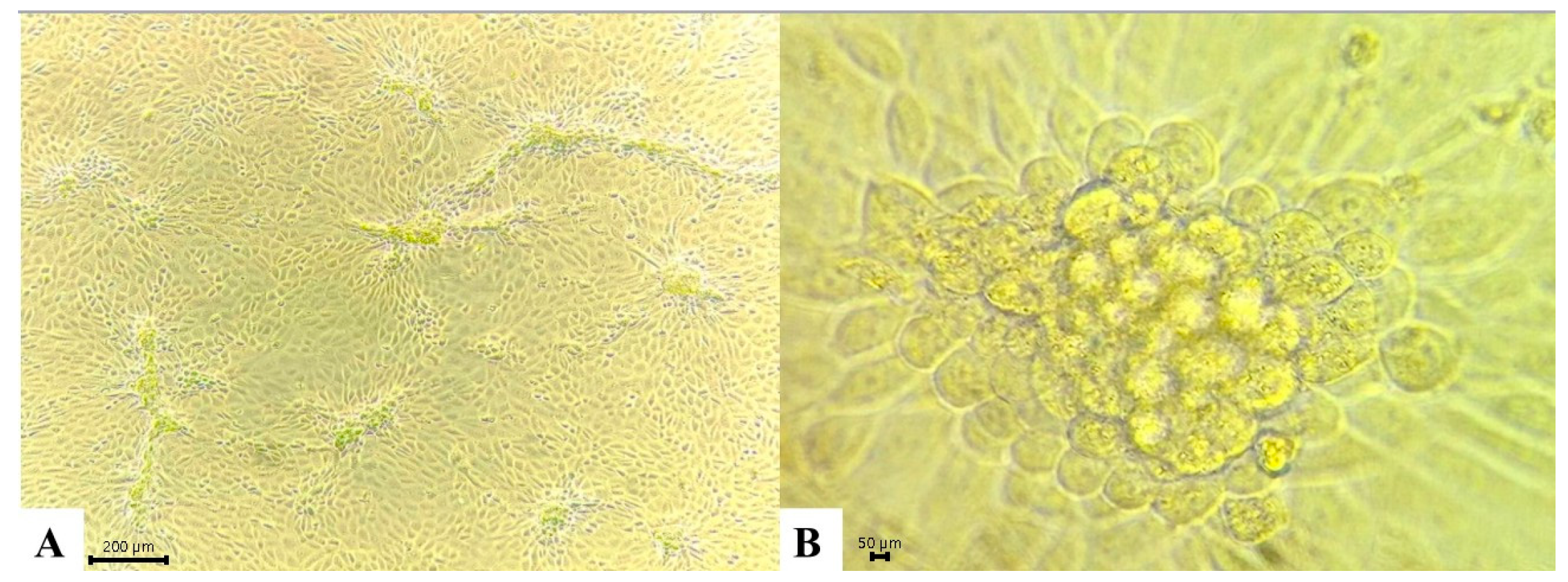 Development and Validation of a Population Assay for the Seroprevalence ...
