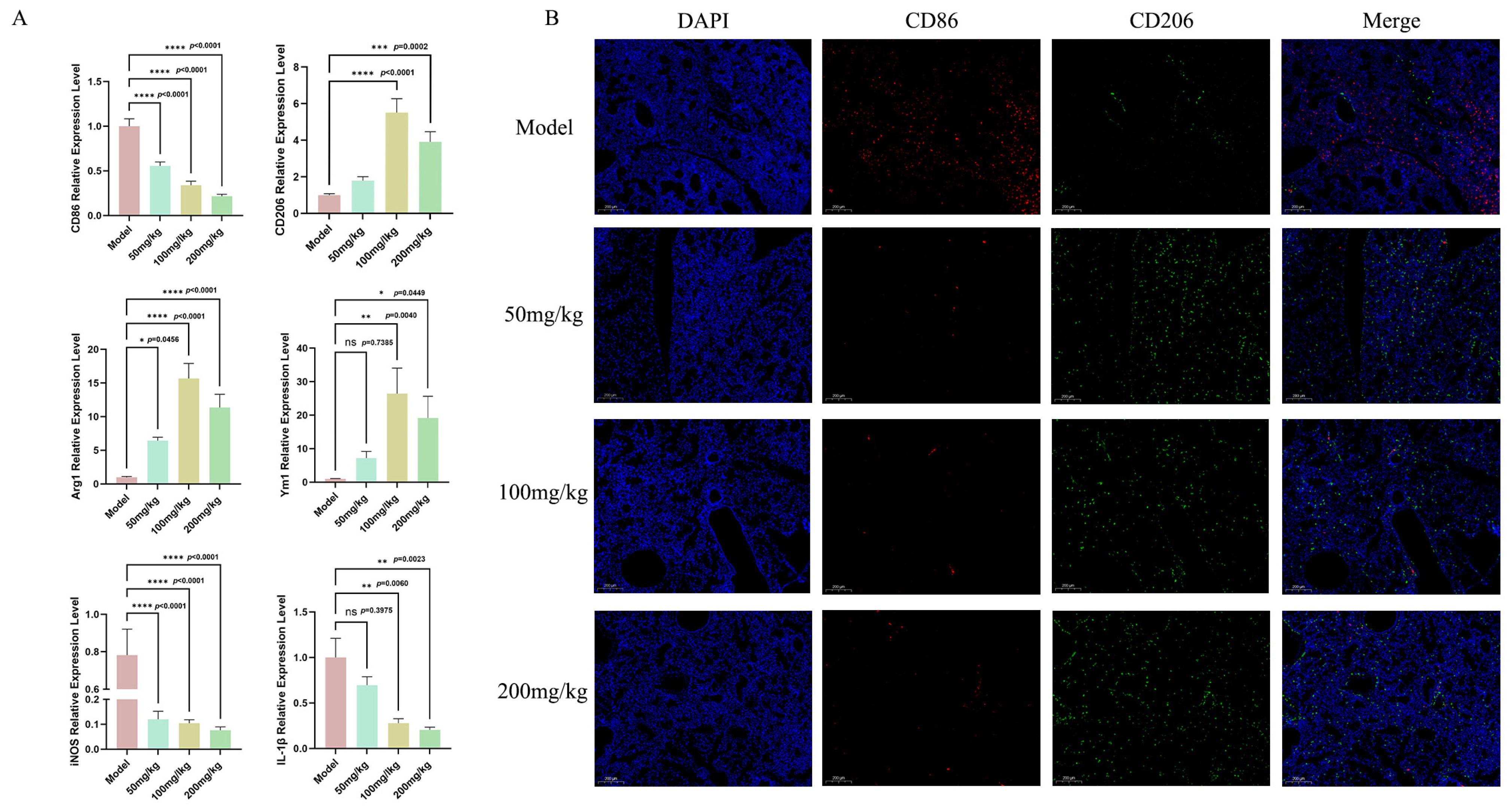 Monosodium Glutamate Inhibits Pseudomonas aeruginosa-Induced Acute Lung ...