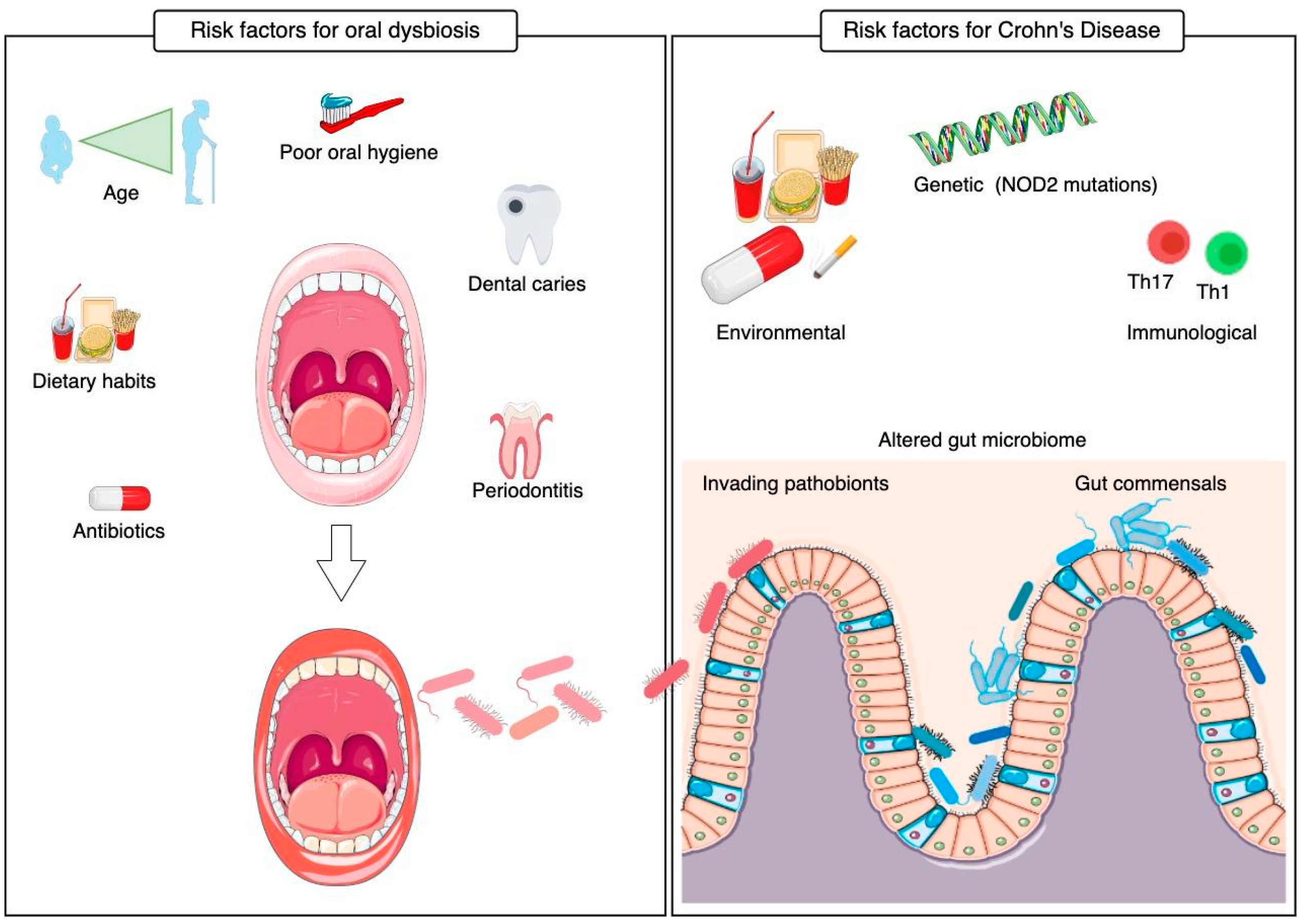 Oral–Gut Microbiome Axis in Crohn’s Disease: A Potential Role of ...