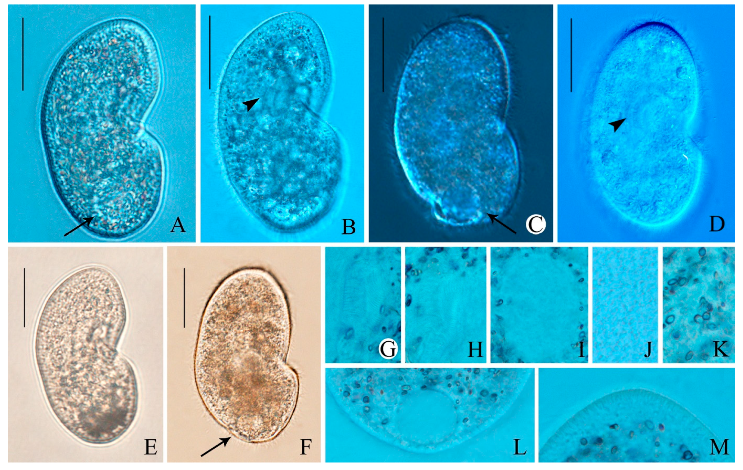Morphological and Molecular Phylogeny of Two New Ciliate Species ...