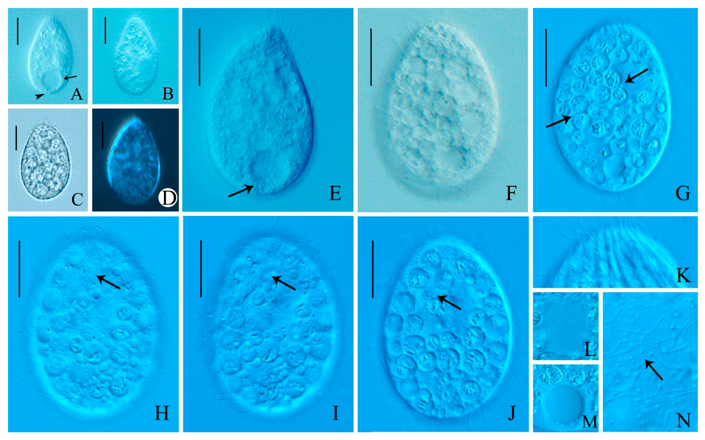 Morphological and Molecular Phylogeny of Two New Ciliate Species ...