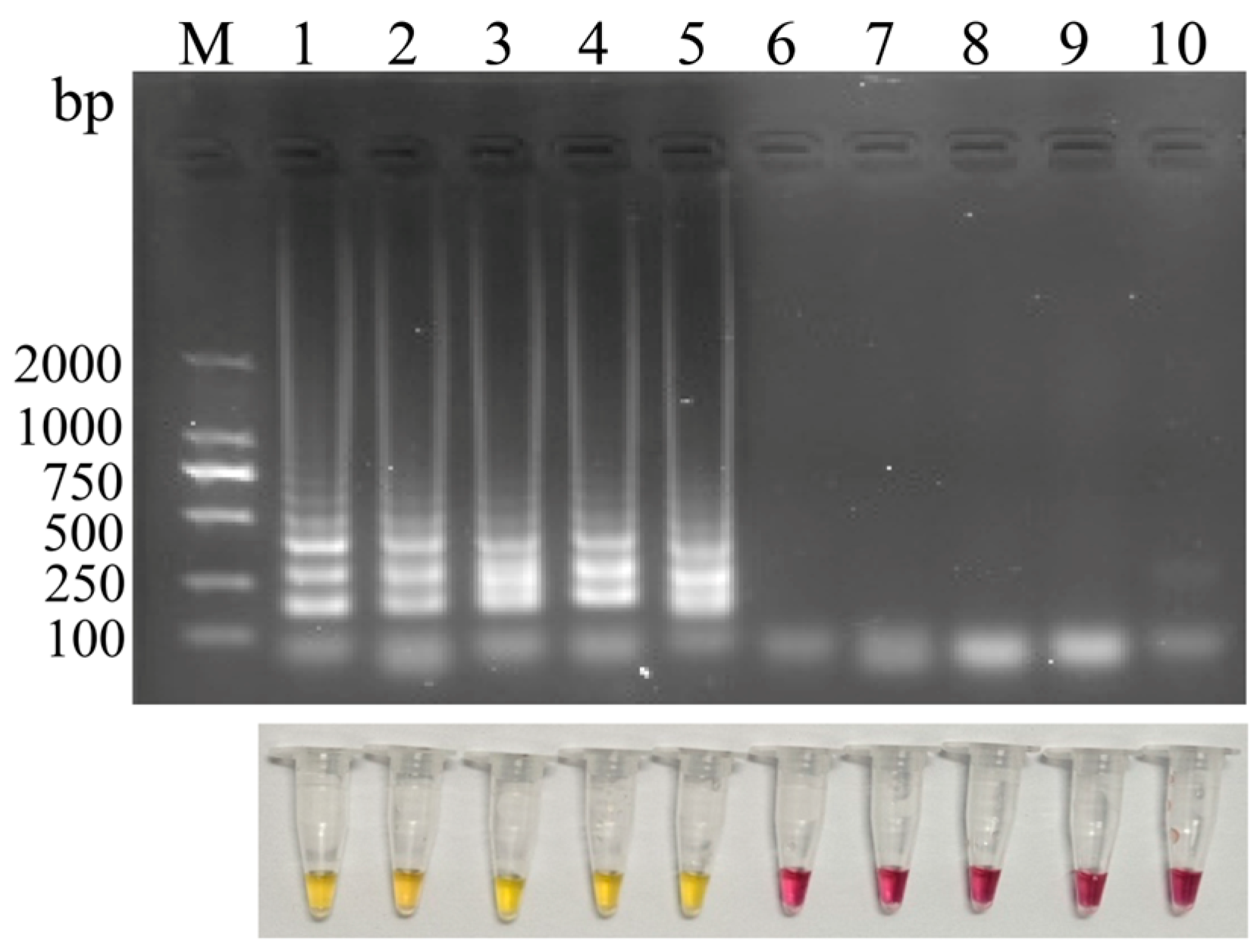 A Comprehensive Visual Detection Strategy: Versatile LAMP Assay with ...