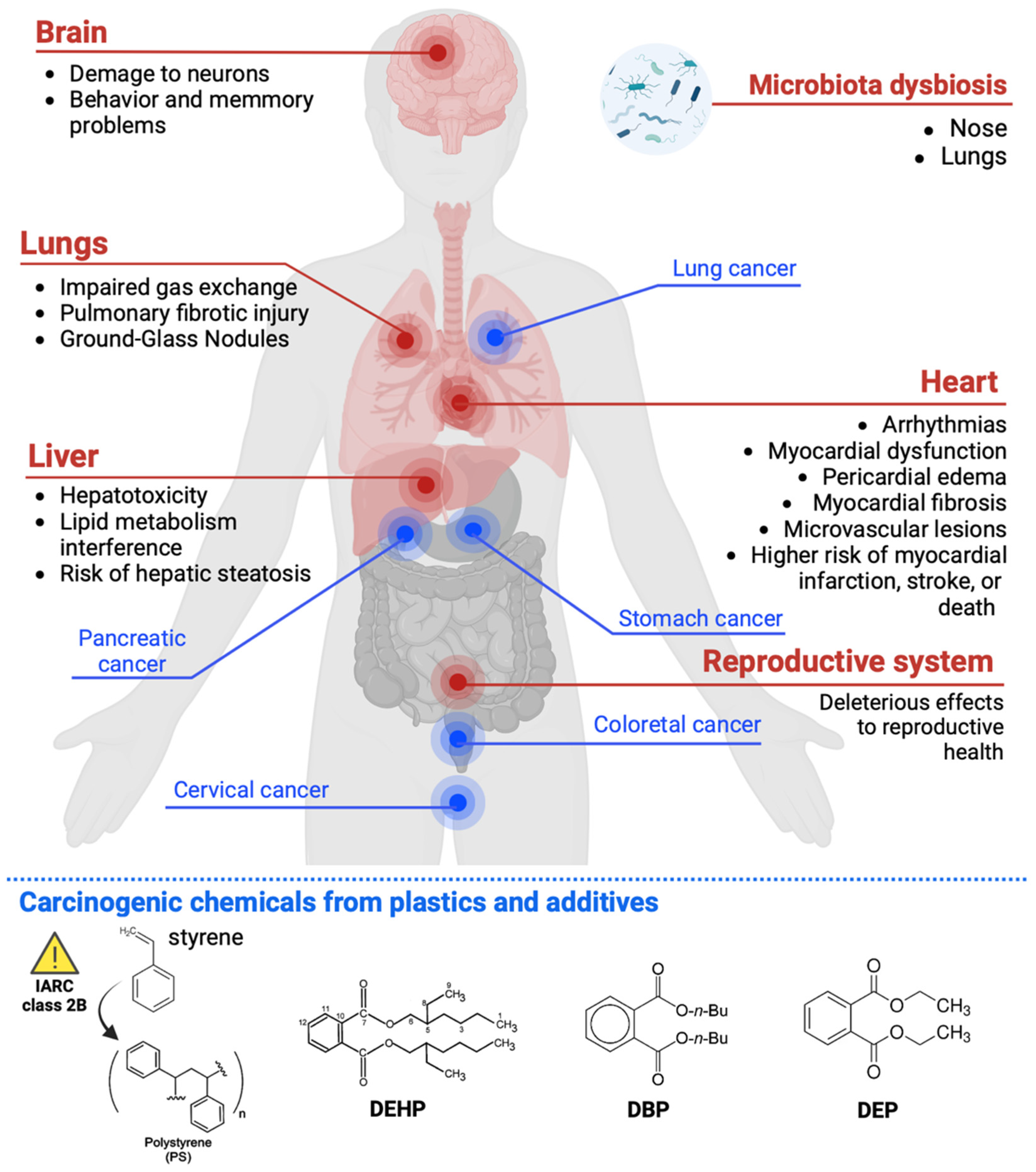 Micro And Nanoplastics On Human Health And Diseases Perspectives And Micro And Nanoplastics On Human Health And Diseases Perspectives And