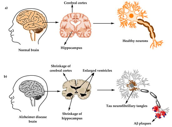 Early identification of Alzheimer's disease in mouse models