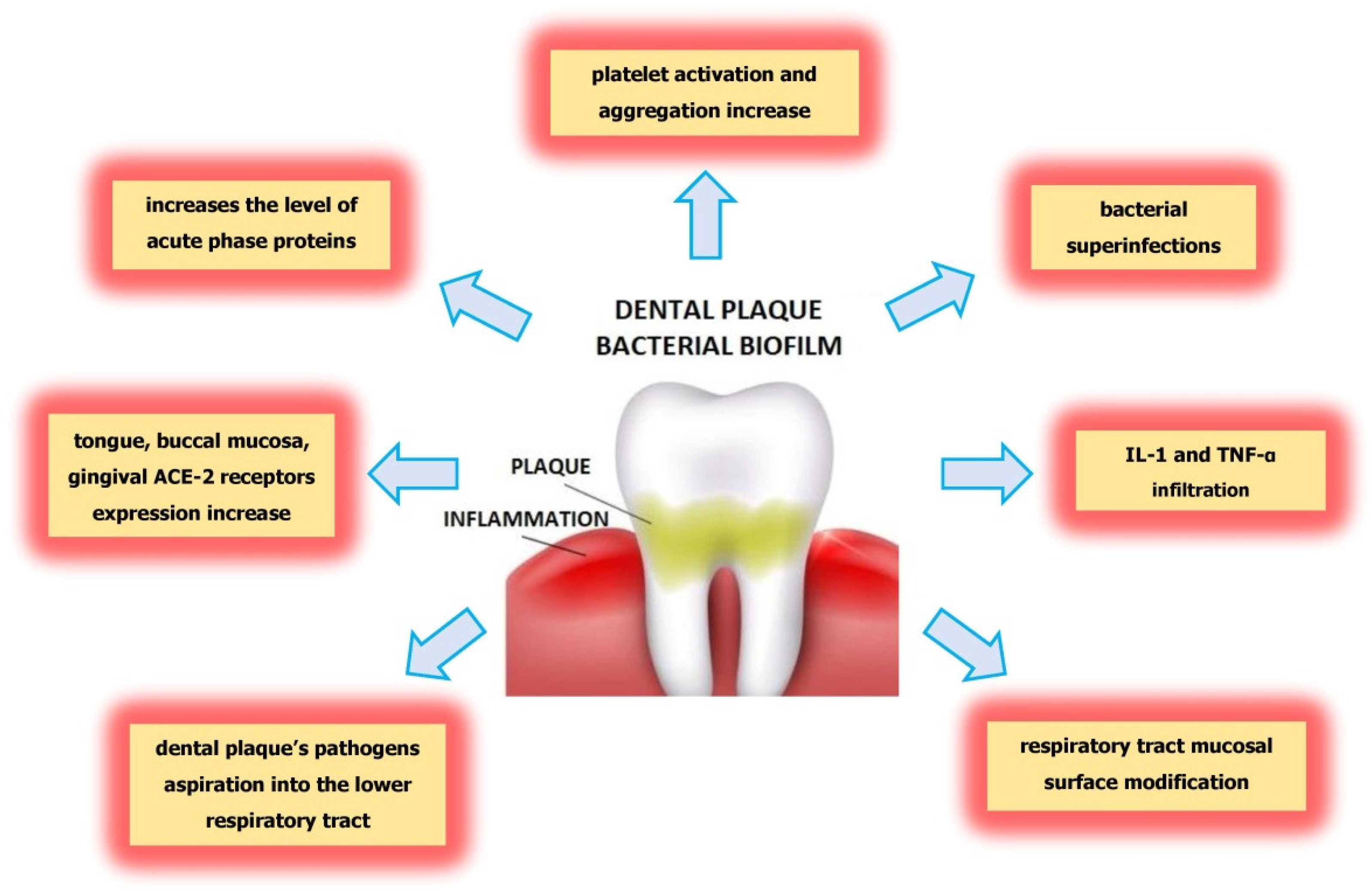 Dental plaque  Benefits and disadvantages of oral bacteria