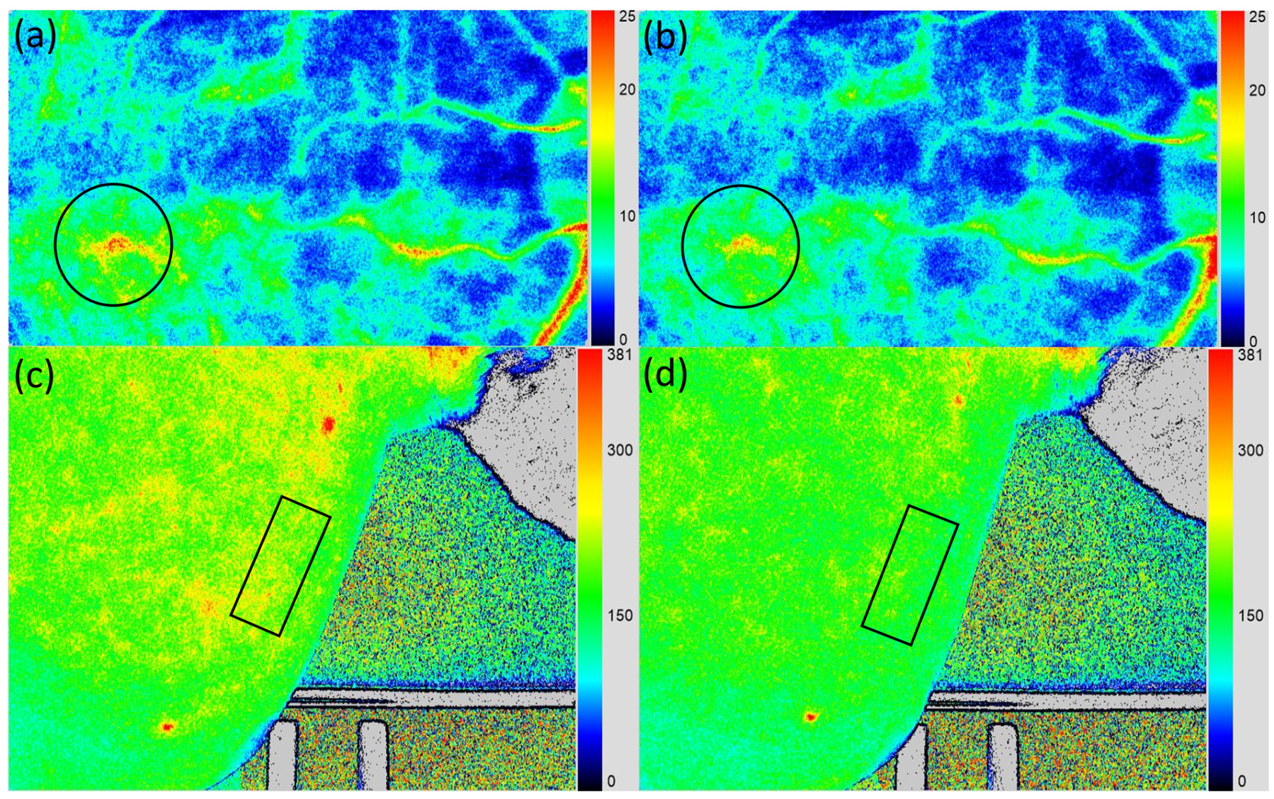 Investigation of Skin Circulation Hemodynamics Using Skin Laser Speckle ...