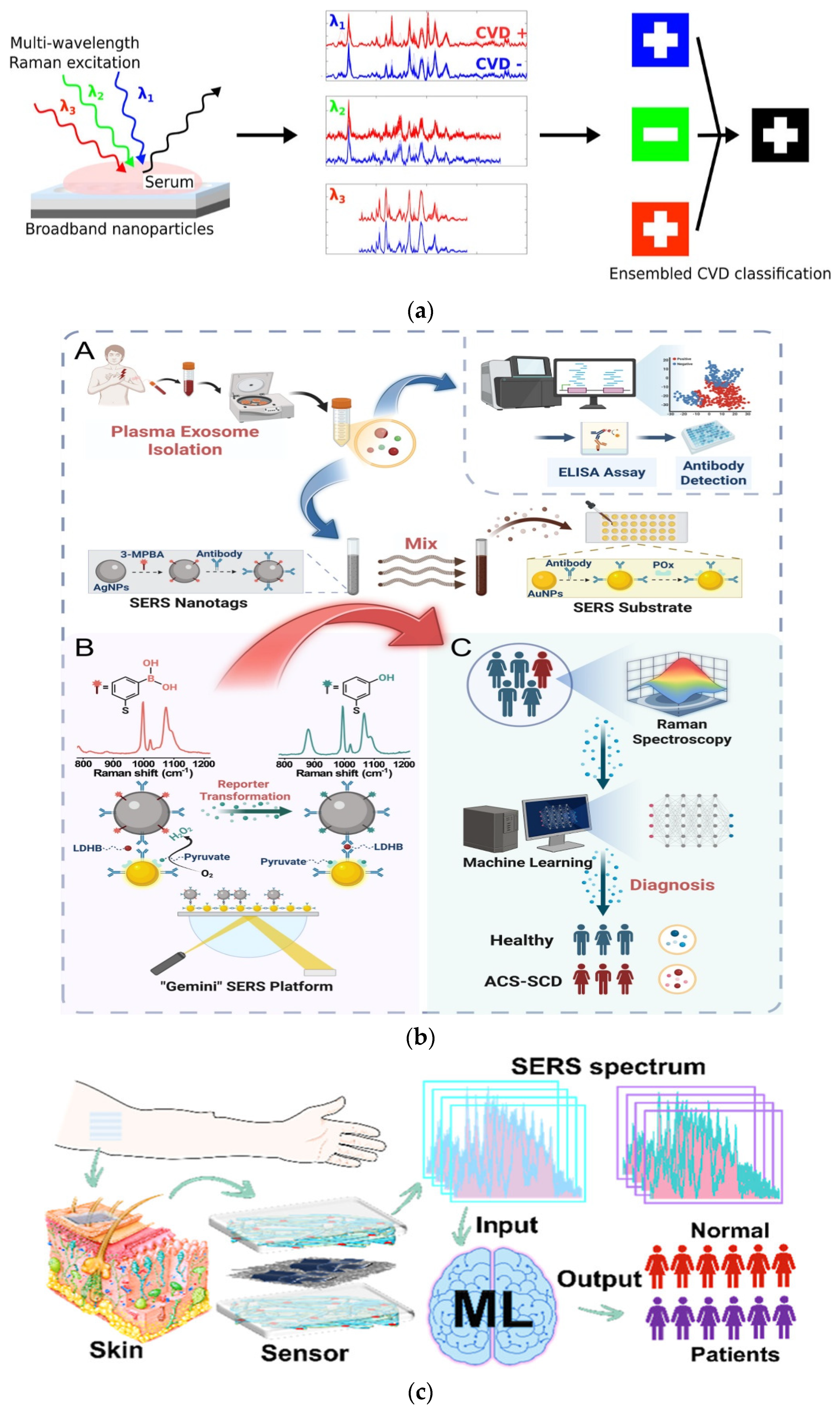 AI-Assisted Surface-Enhanced Raman Spectroscopy for Cardiovascular ...