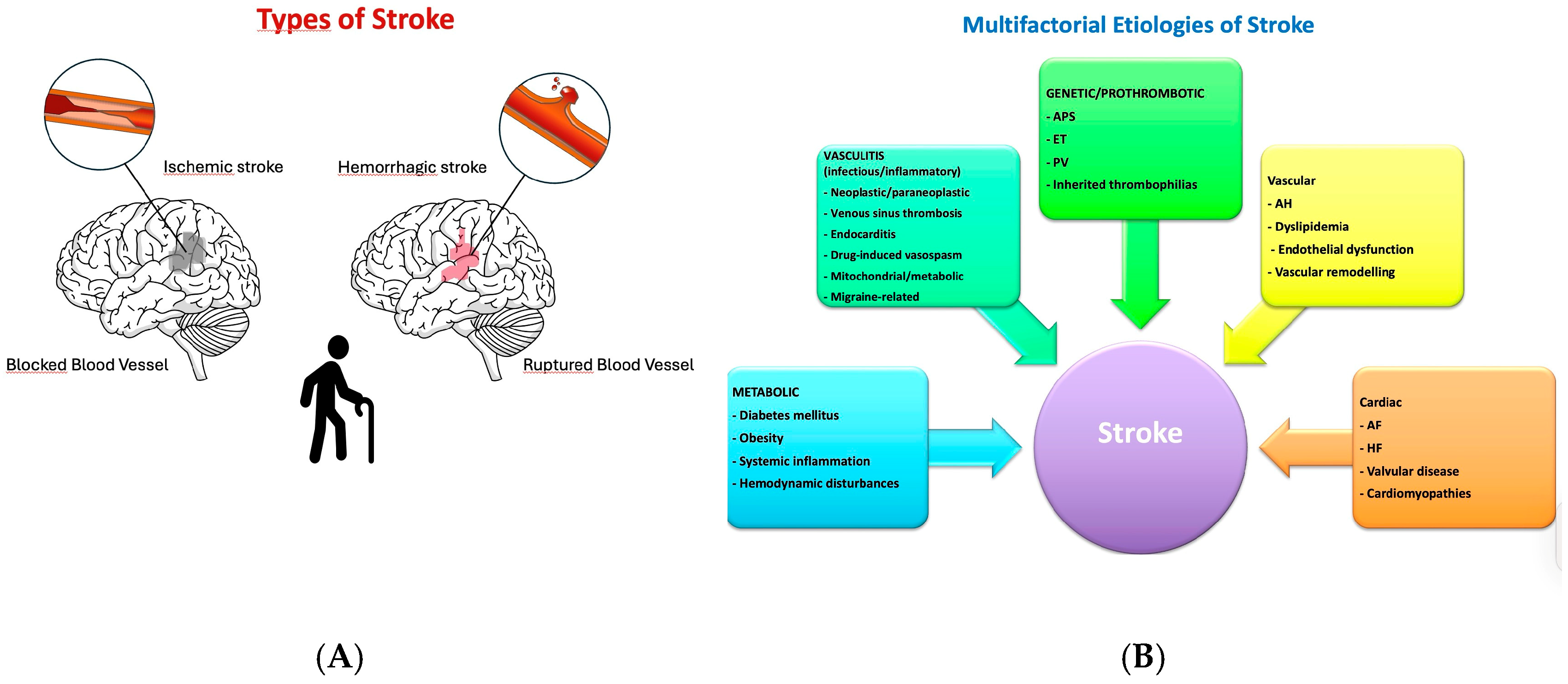 Primary and Secondary Prevention of Ischemic Stroke in Elderly Patients ...