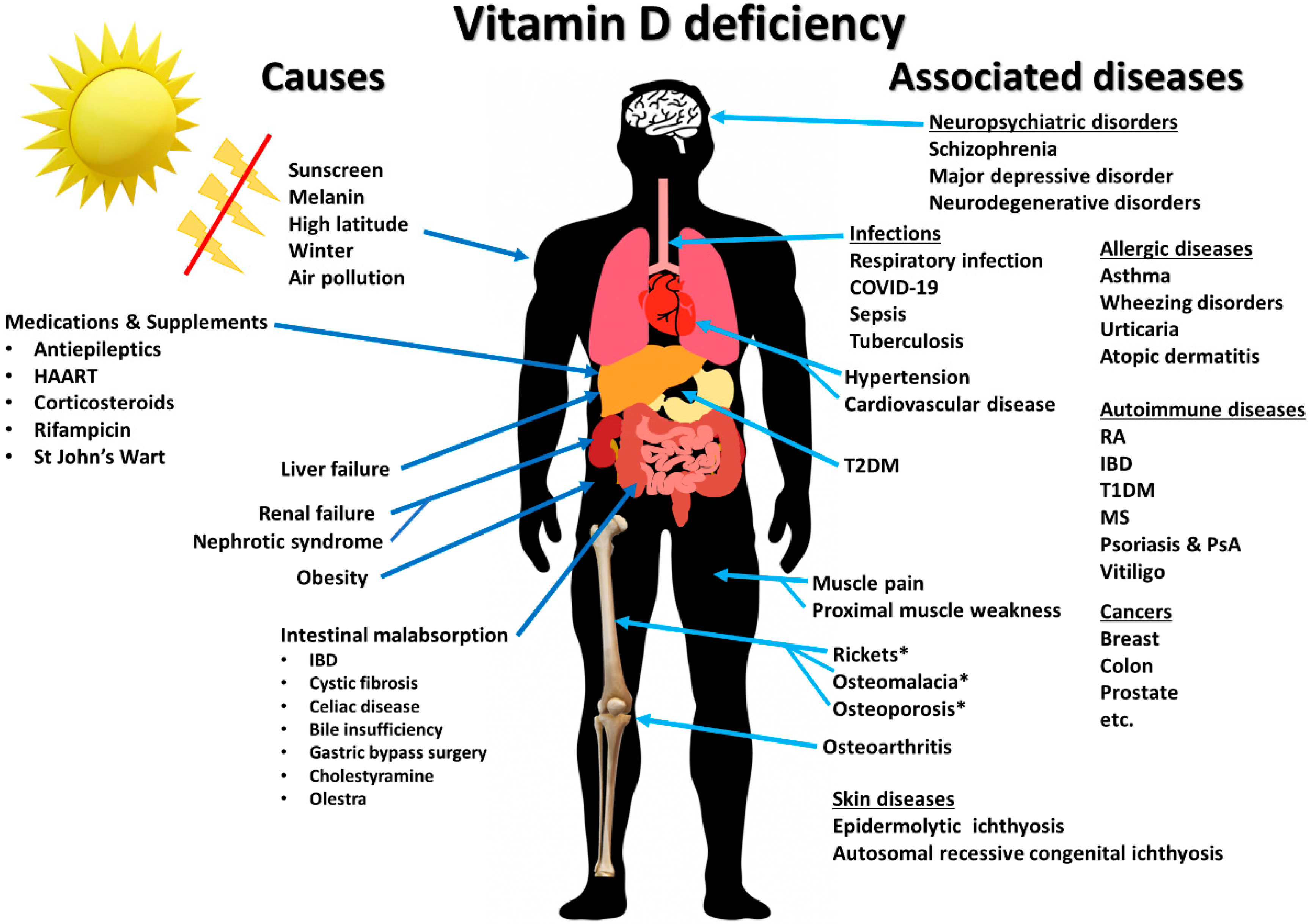 What are the neurological symptoms of vitamin D deficiency?