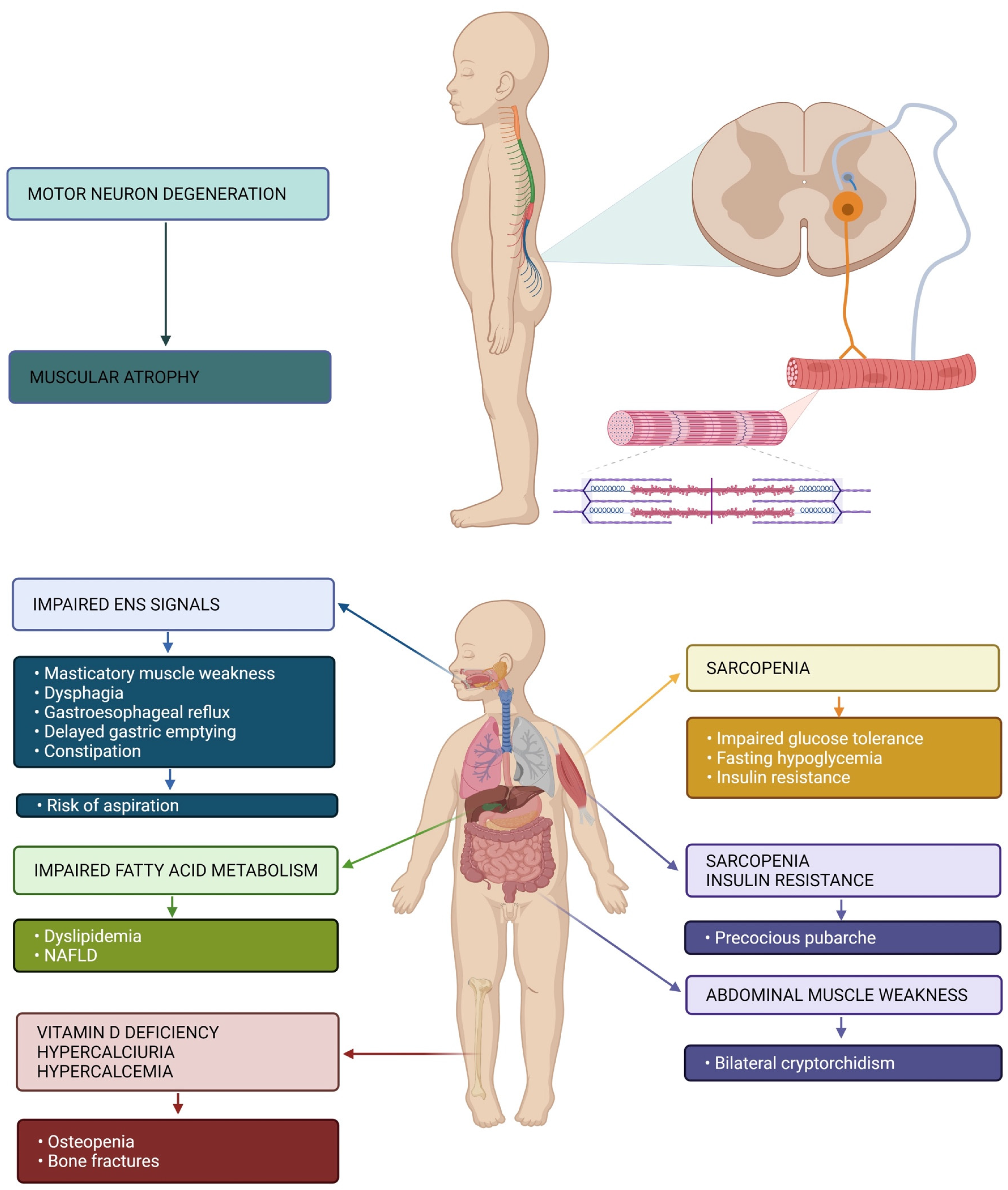 Nutrients Free Full-Text Nutritional, Gastrointestinal and Endo-Metabolic Challenges in the Management of Children with Spinal Muscular Atrophy Type 1