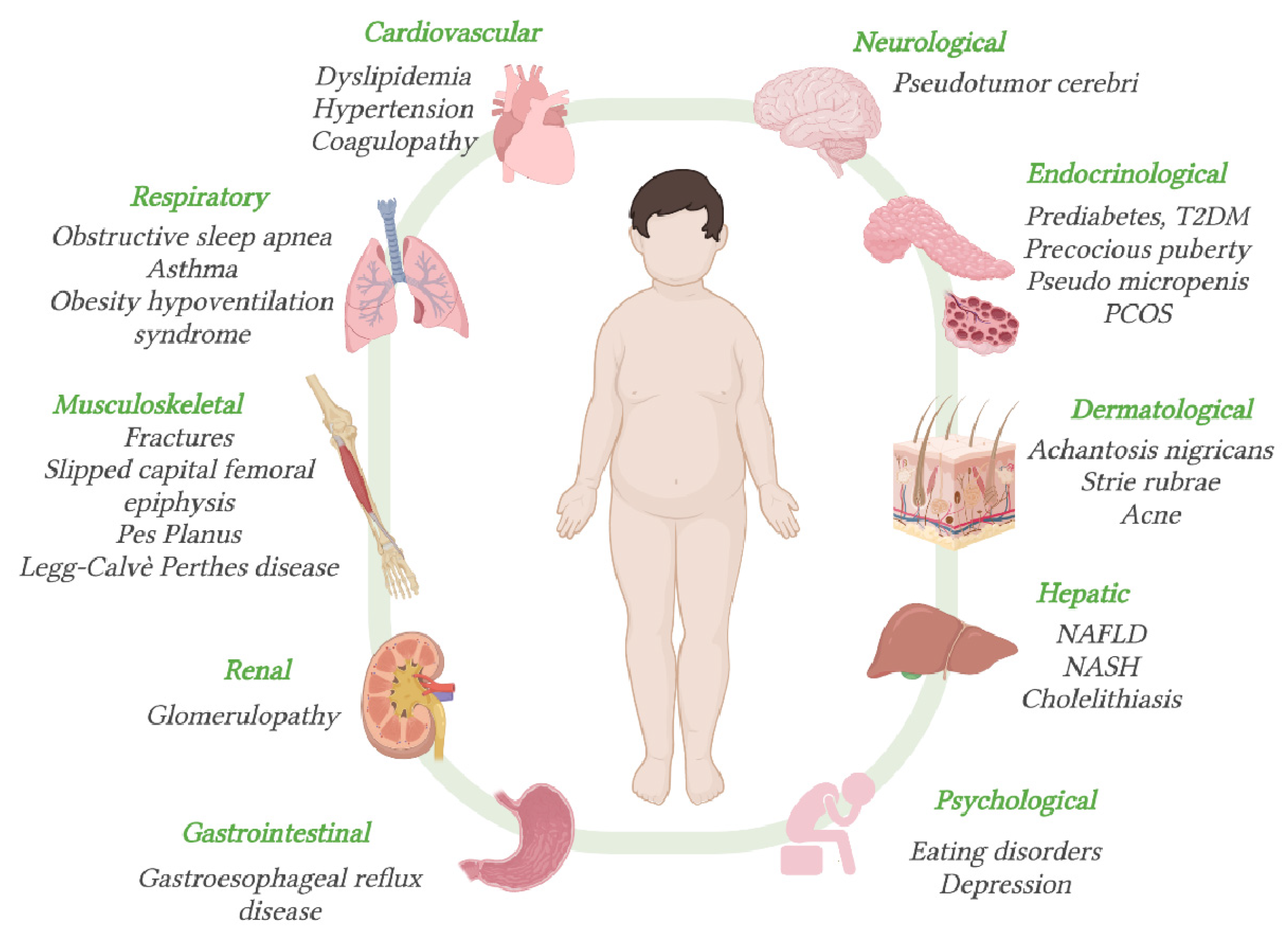 Nutrients Free Full-Text Metabolic Derangement in Pediatric Patient with Obesity The Role of Ketogenic Diet as Therapeutic Tool