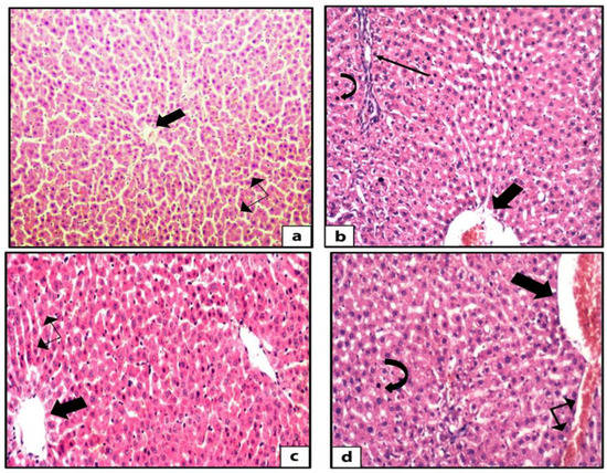 Modulation of Dyslipidemia Markers Apo B/Apo A and Triglycerides/HDL ...