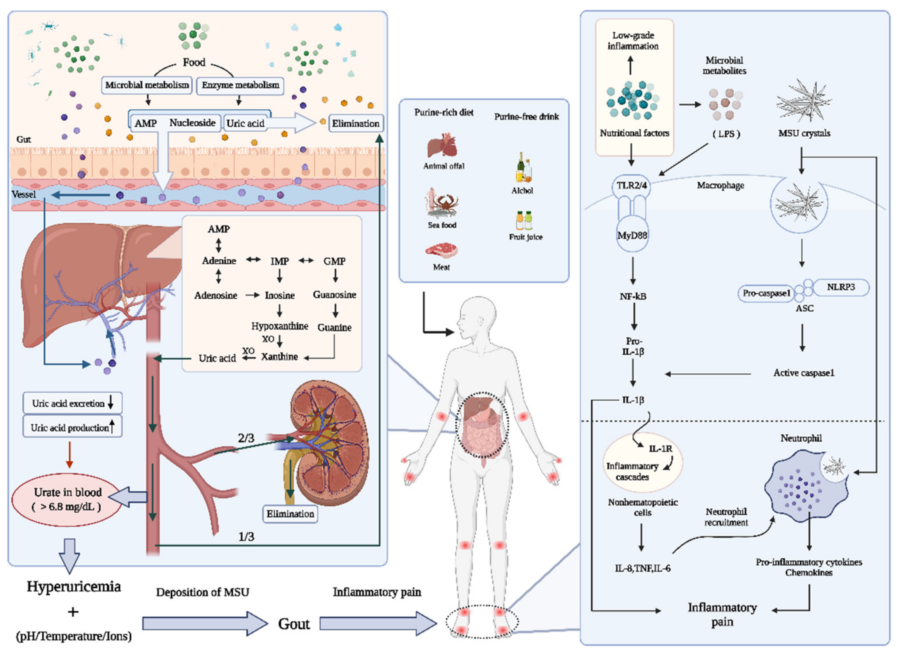 Nutrients | Free Full-Text | Gout and Diet: A Comprehensive Review of Mechanisms and Management