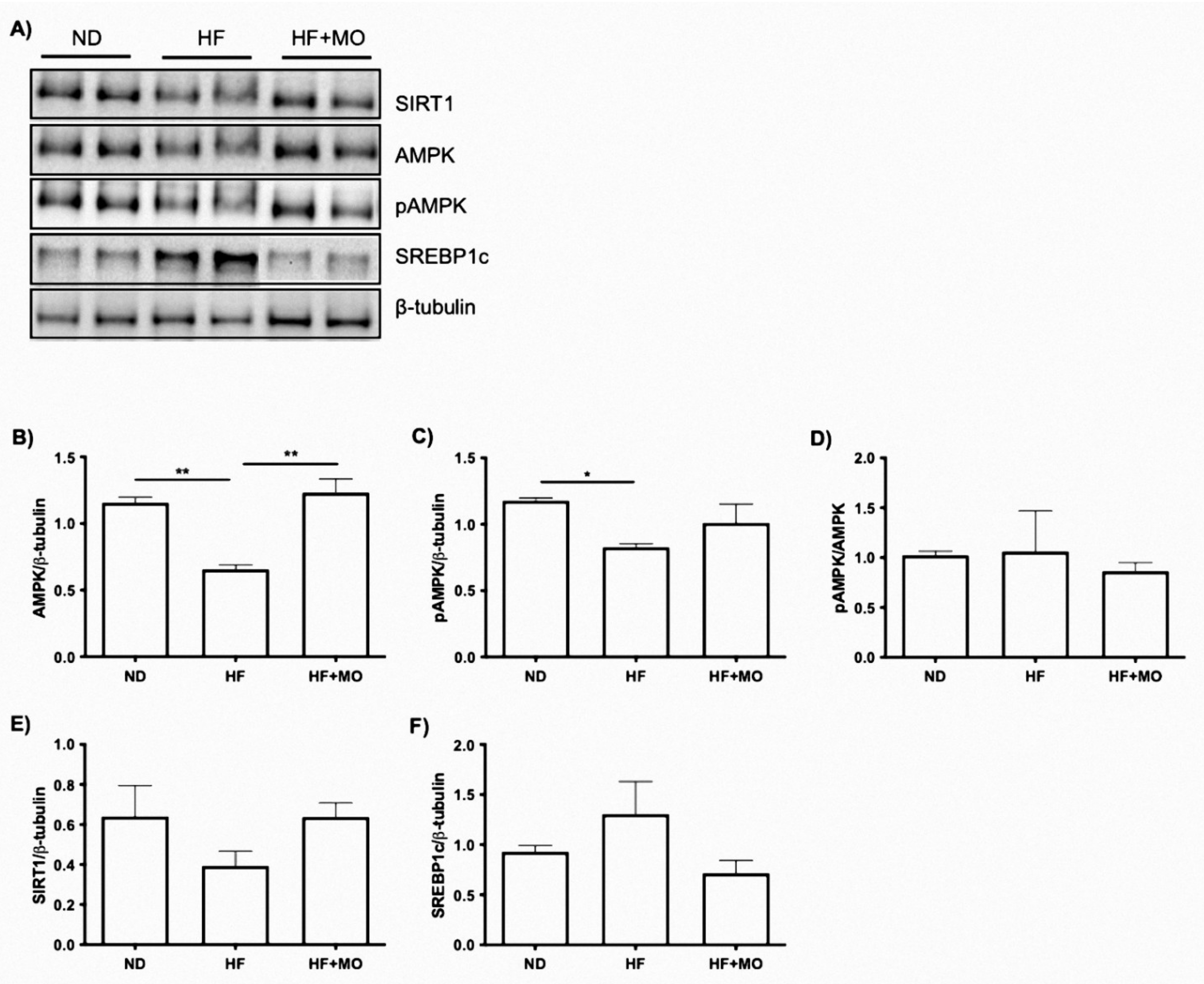 Nutrients | Free Full-Text | Moringa oleifera Improves MAFLD by