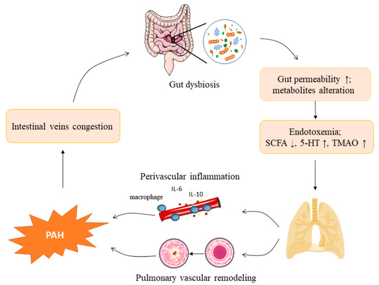 The Role and Mechanism of Gut Microbiota in Pulmonary Arterial Hypertension