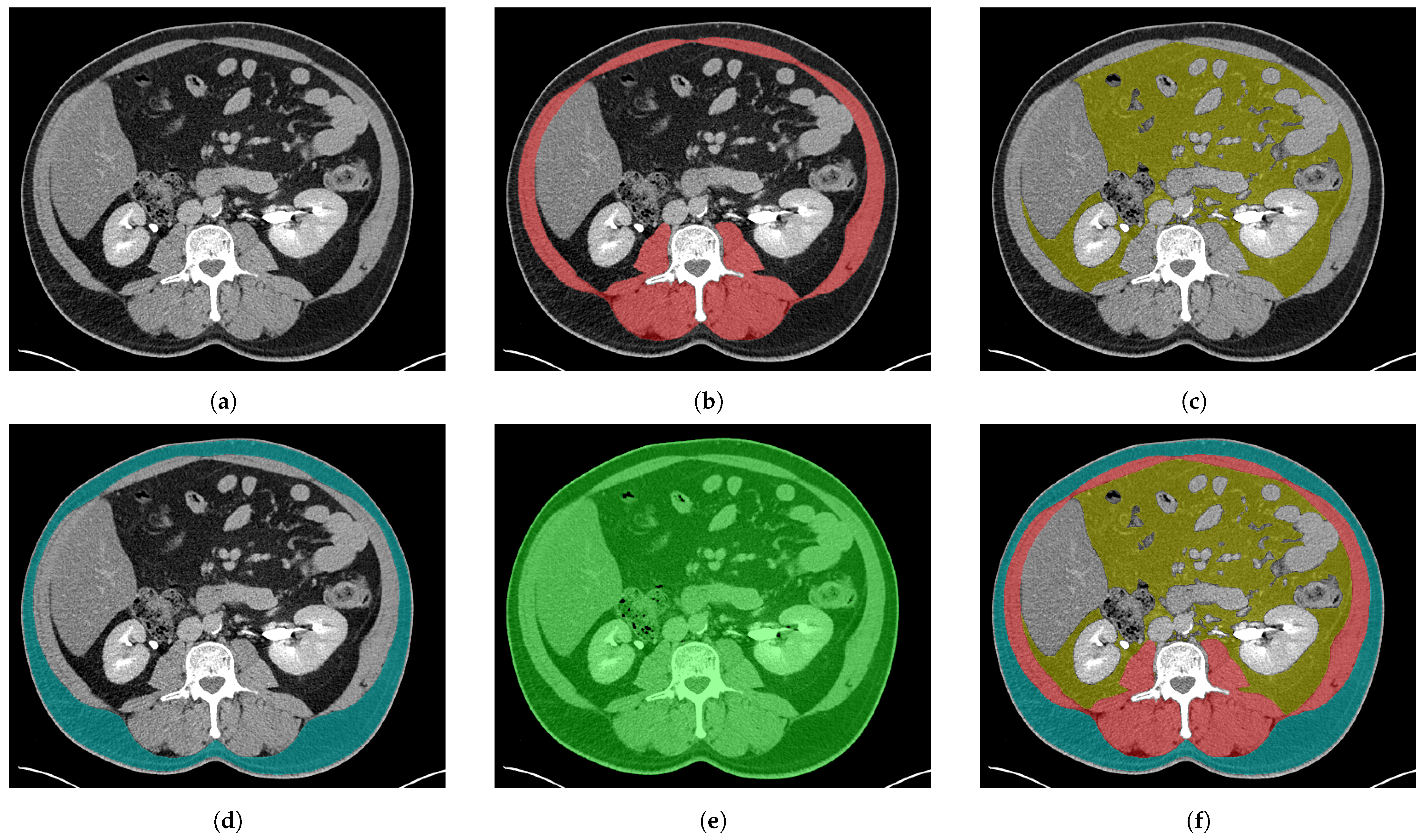 FocusedON-BC: A Robust Deep Learning Framework for Automated Body ...